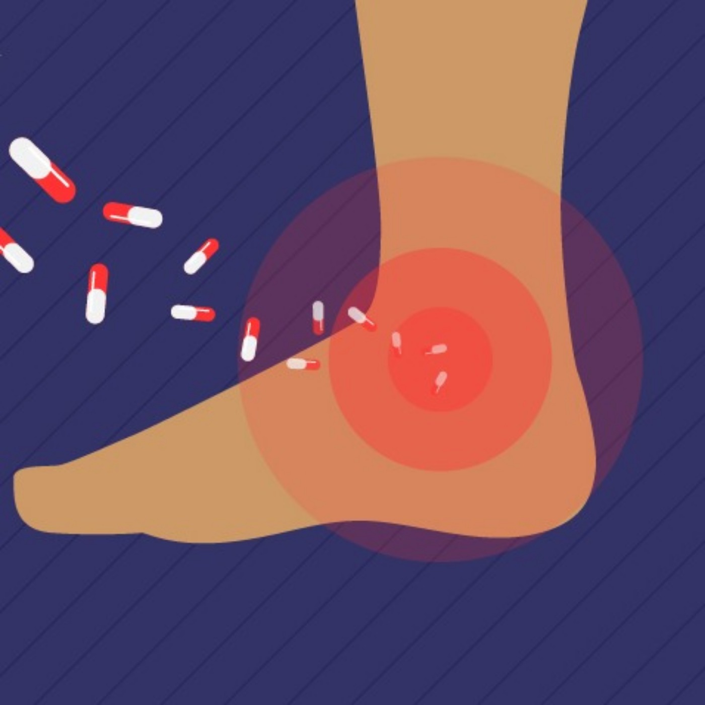 Managing Pain After An Ankle Sprain | Michigan Medicine