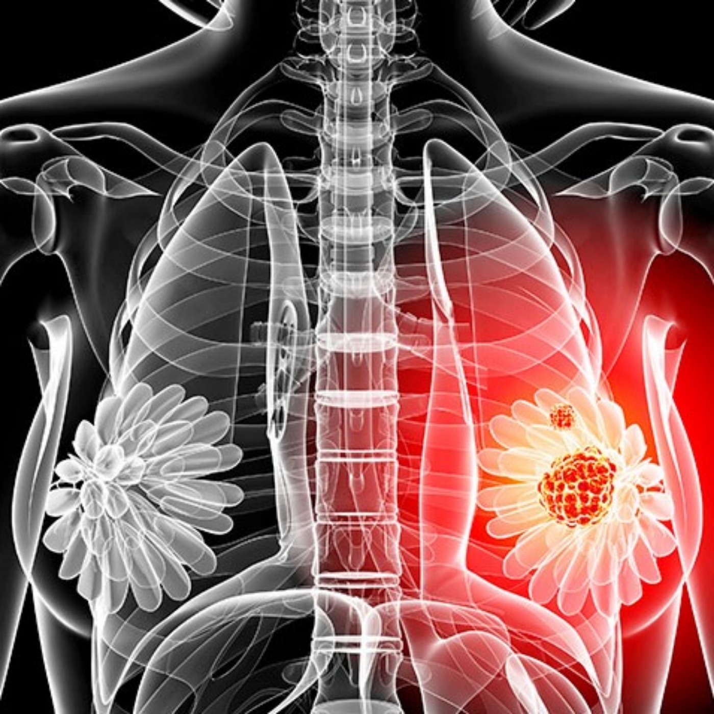 Mastitis: What You Should Know | Michigan Medicine