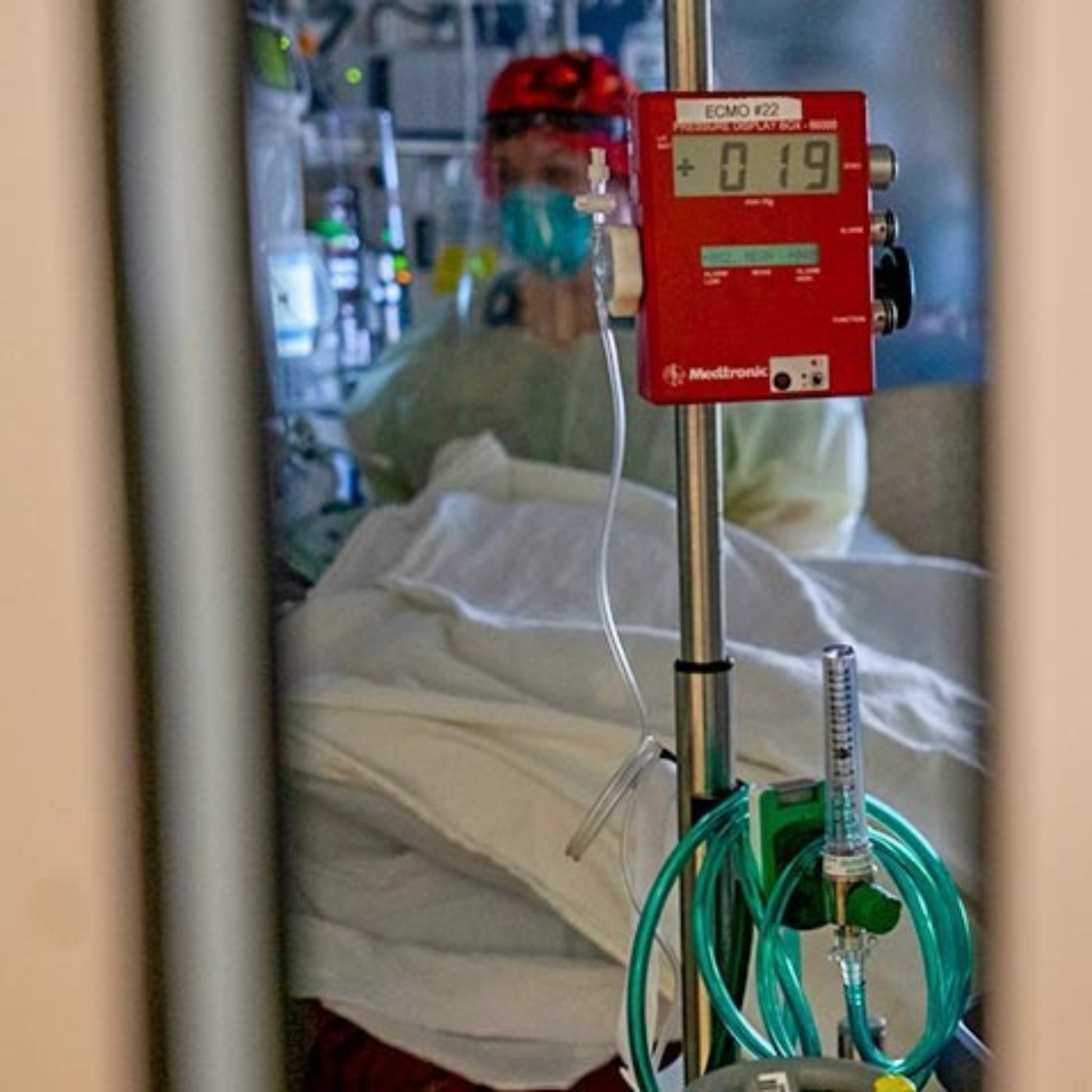 How ECMO Could Help COVID-19 Patients | Michigan Medicine