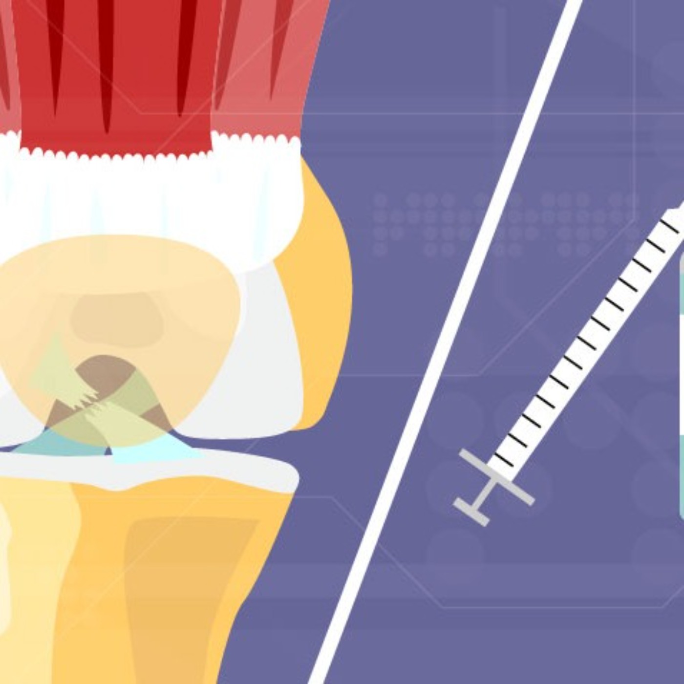 Advancements in HGH Therapy for ACL Injury | Michigan Medicine