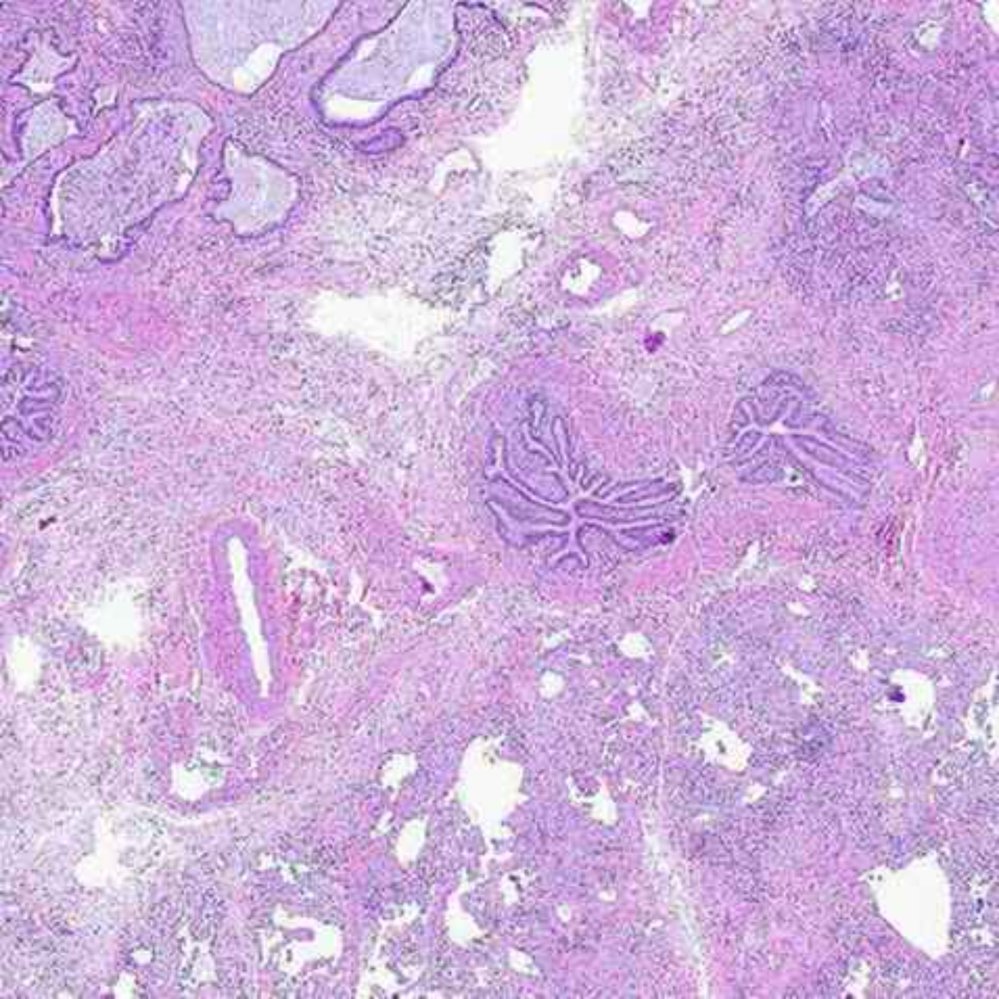 New research casts light on possible cause behind long COVID | Michigan Medicine