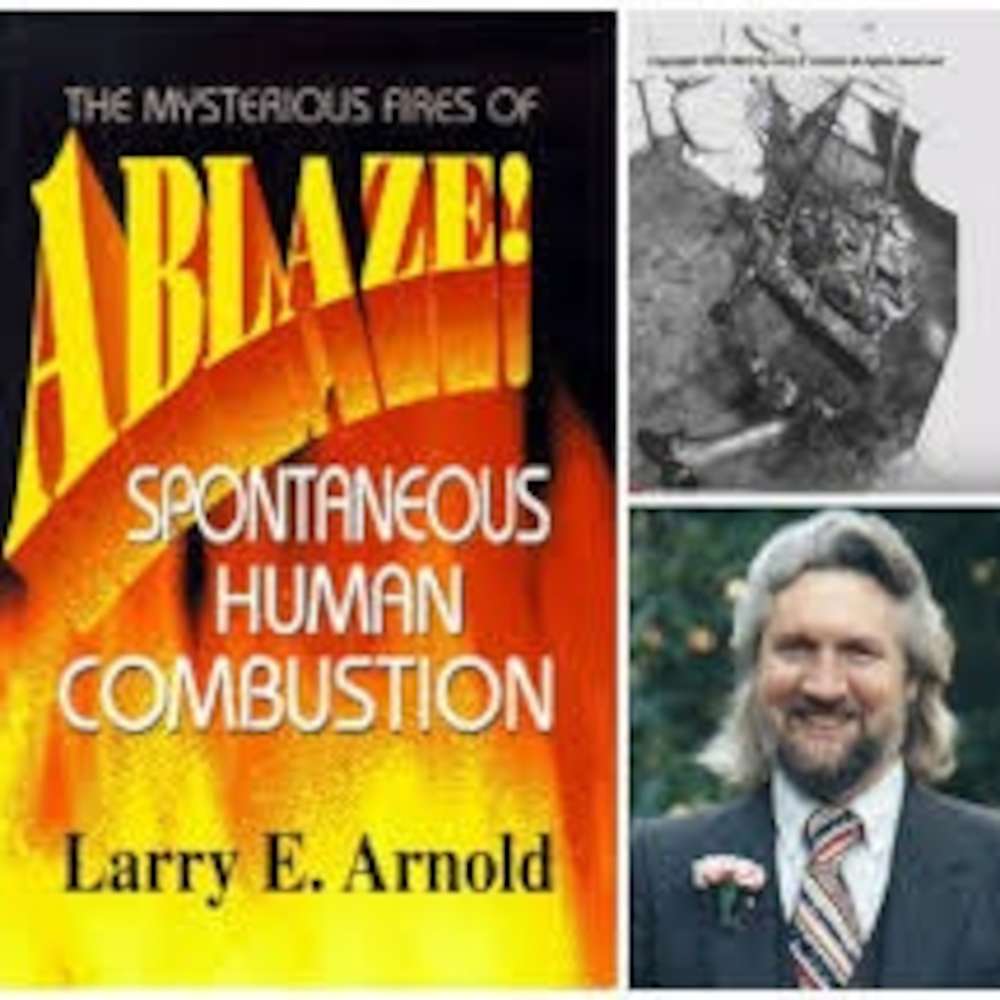 Spomtanious Human Combustion - Larry Arnold