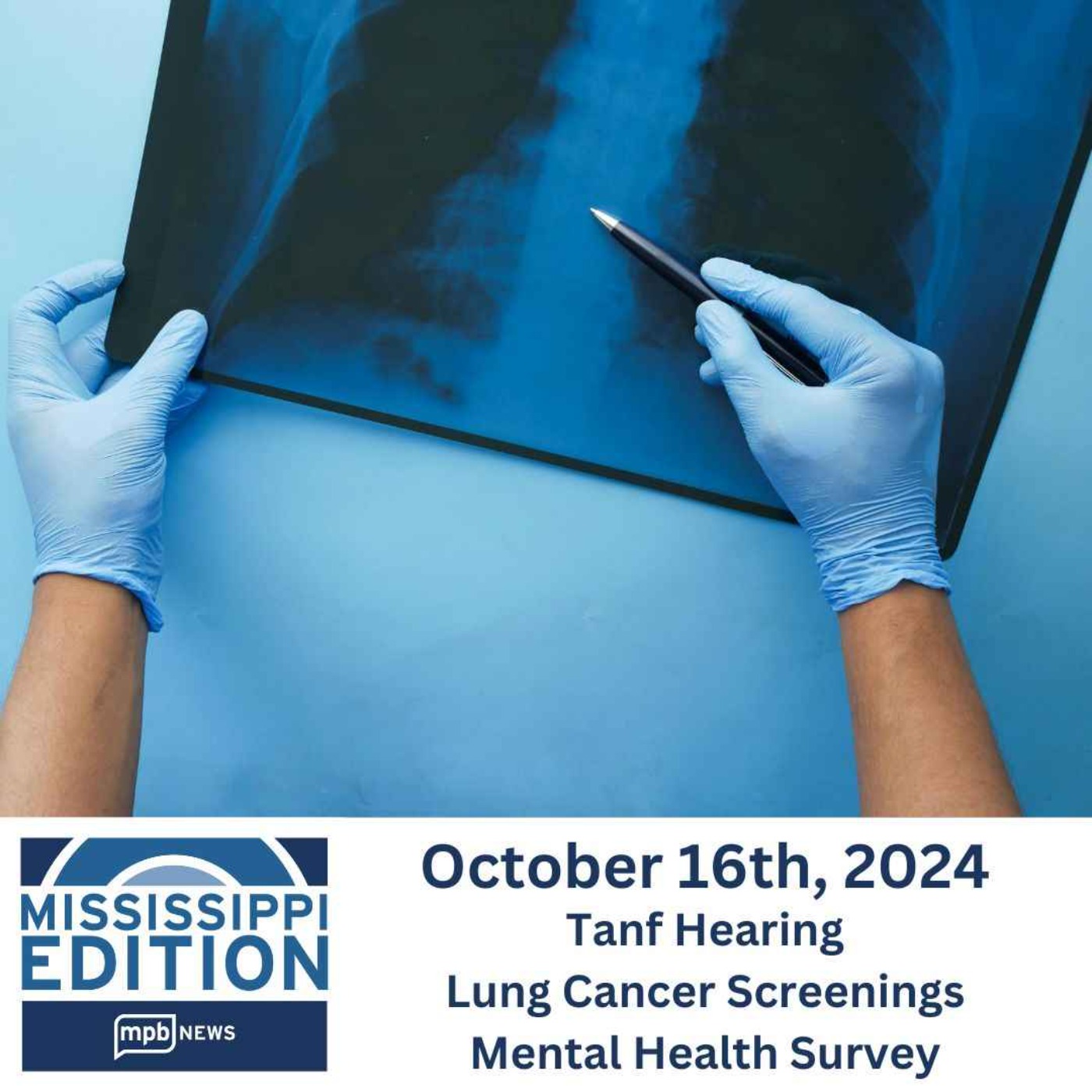 10/16/2024: Tanf Hearing | Lung Cancer Screenings | Mental Health Survey
