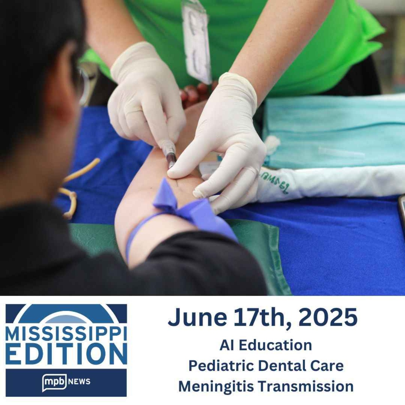 06/17/2025: AI Education | Pediatric Dental Care | Meningitis Transmission episode artwork