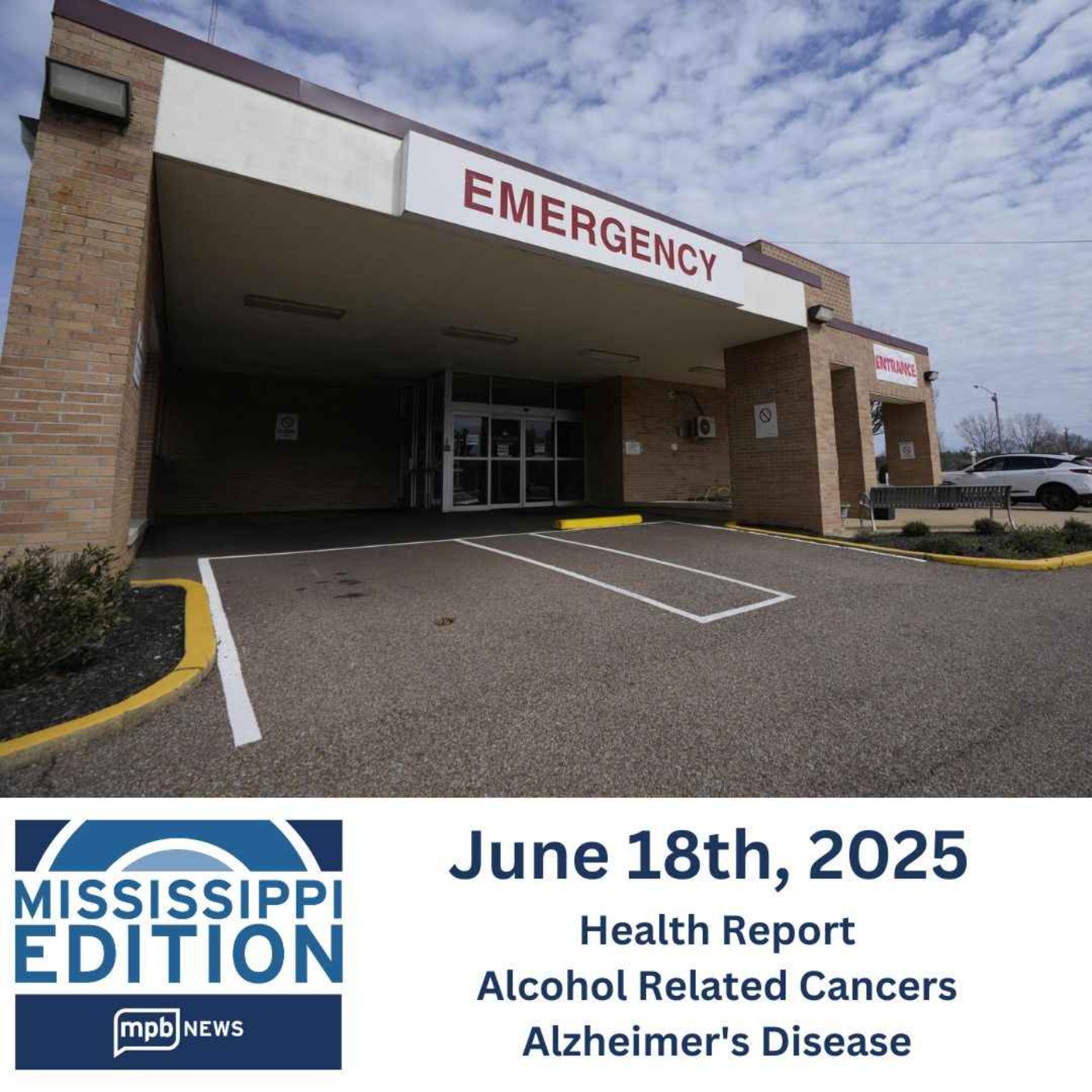 06/18/2025: Health Report | Alcohol Related Cancers | Alzheimer's Disease