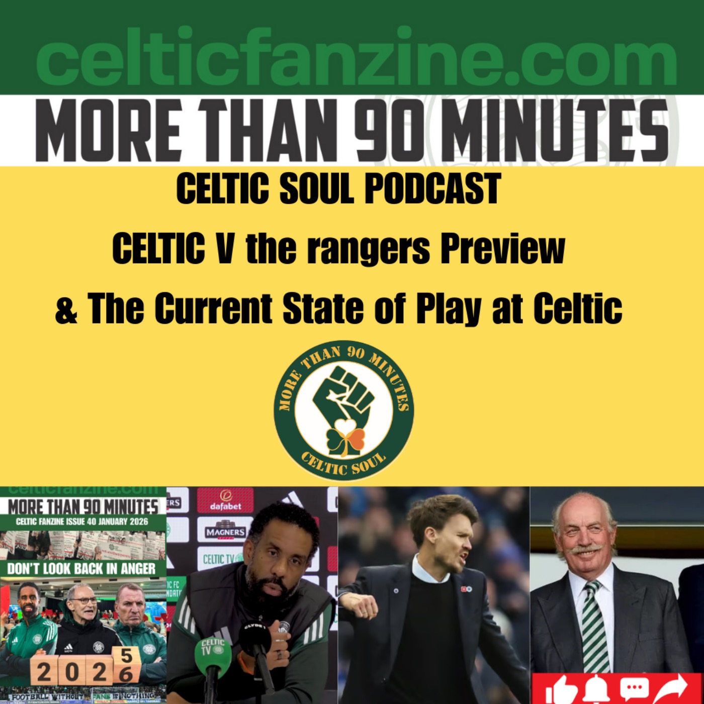 Celtic v the rangers Preview & the current State of Play at Celtic