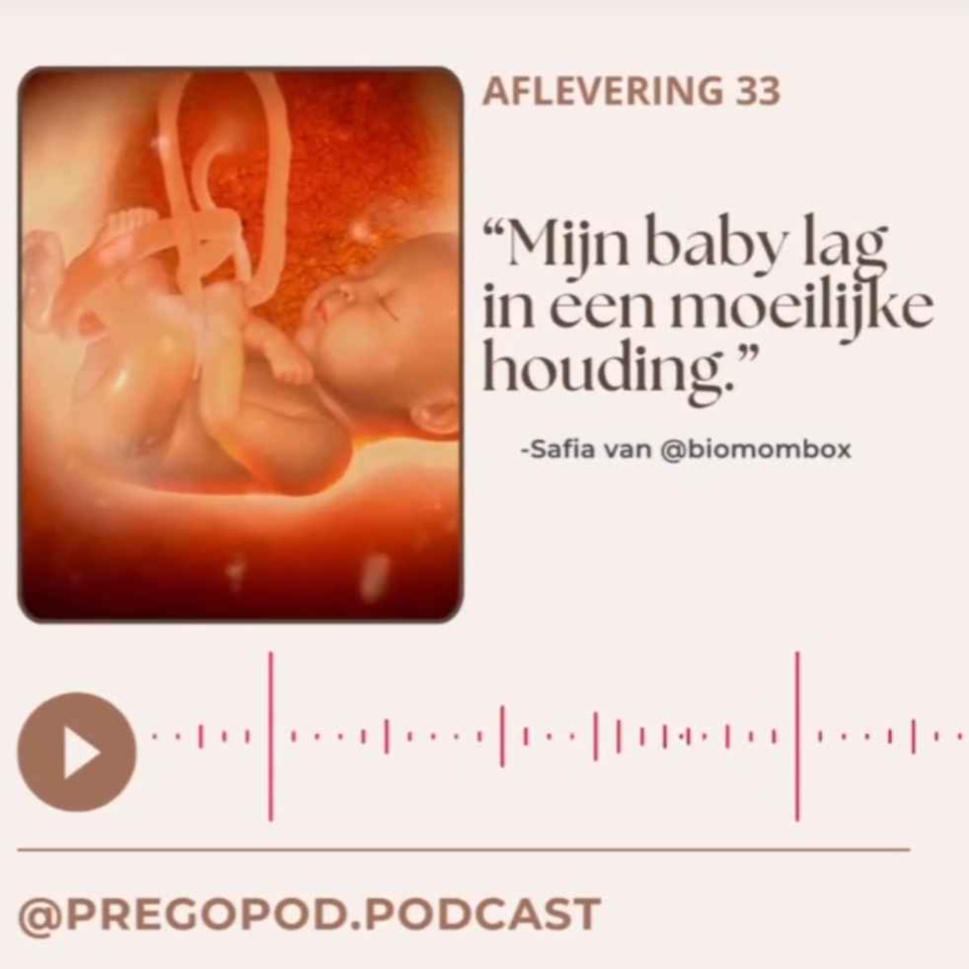 33. "Mijn baby lag in een moeilijke houding"