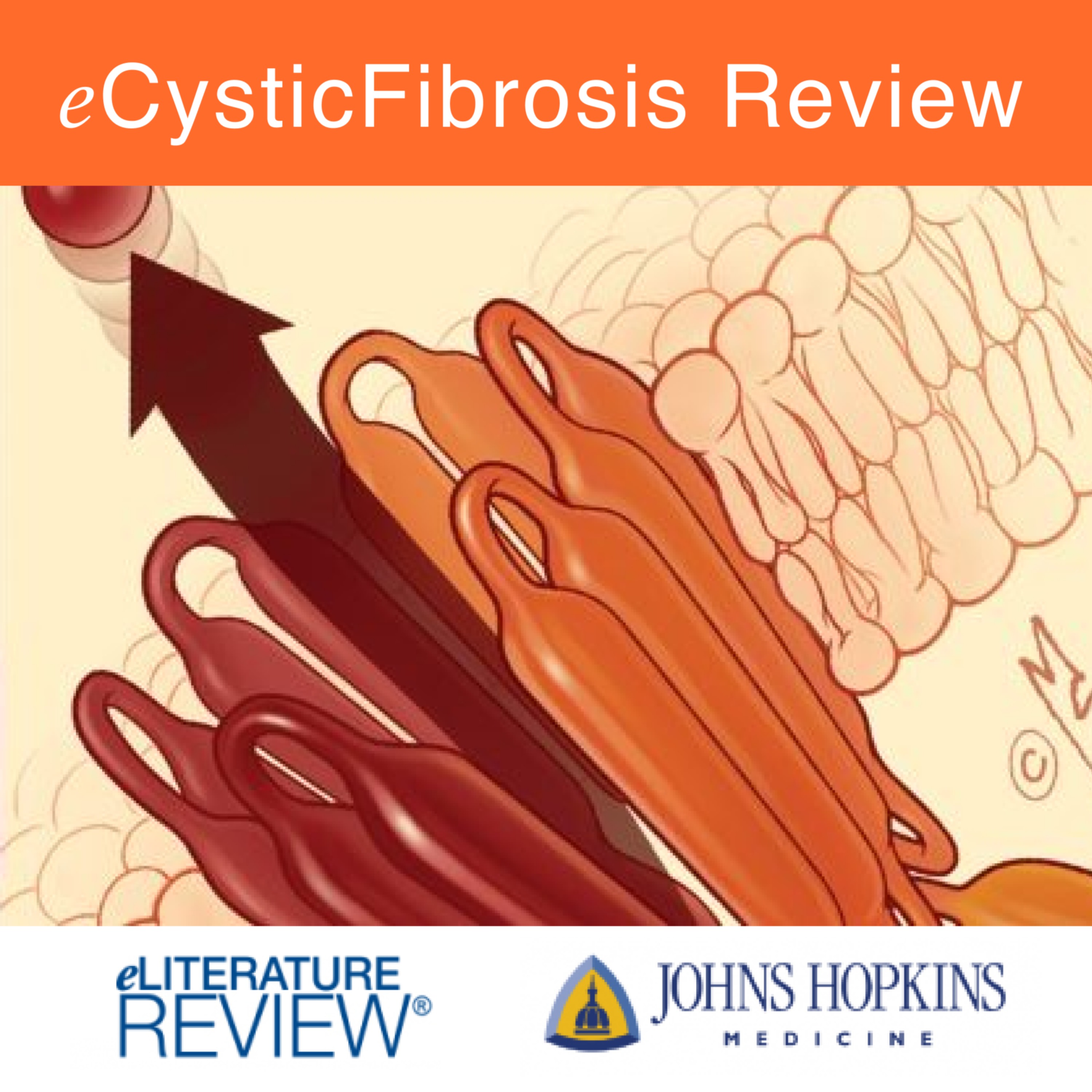 eCysticFibrosis Review
