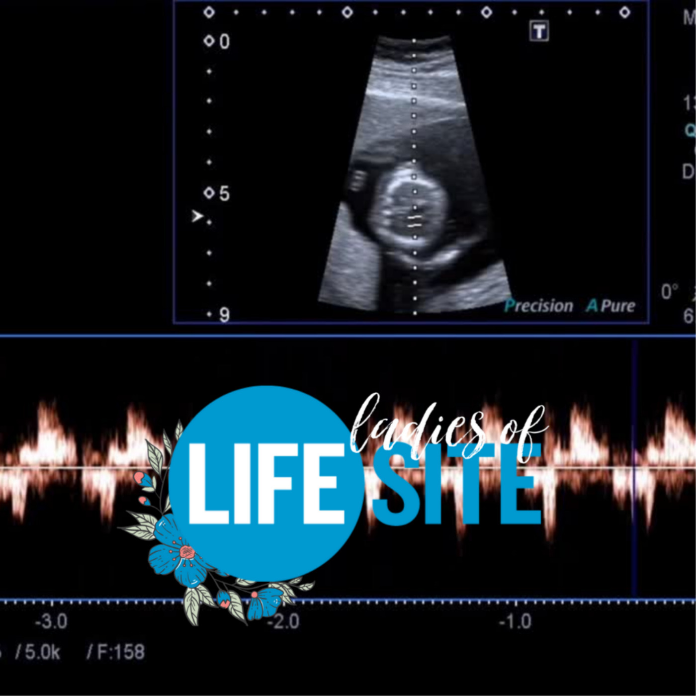 Ladies of LifeSite