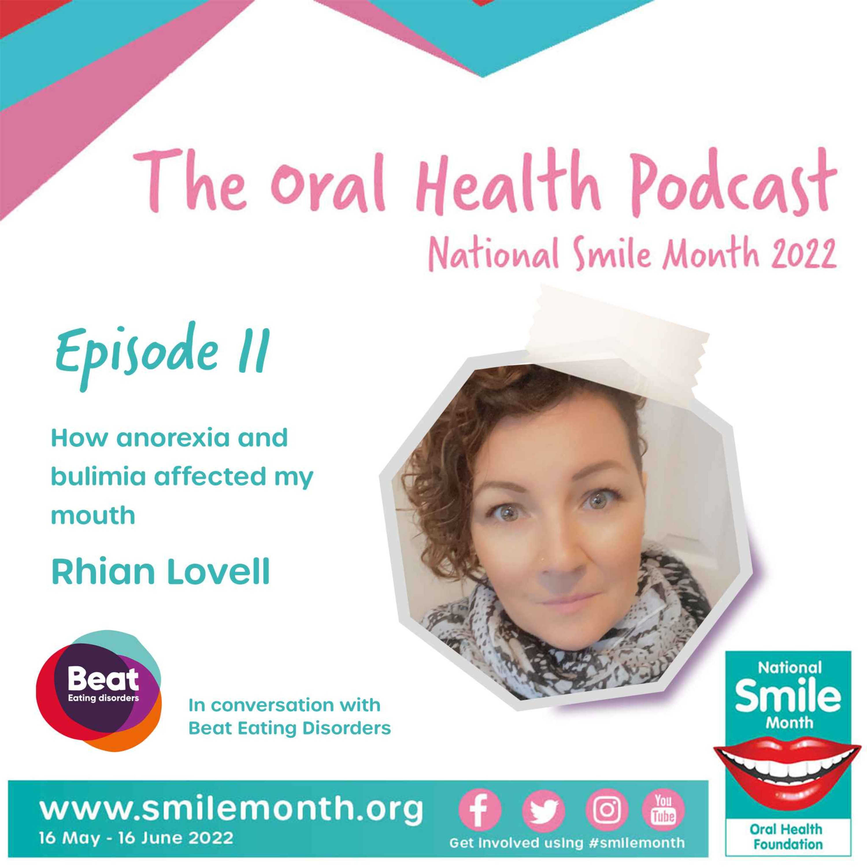 How anorexia and bulimia affected my smile