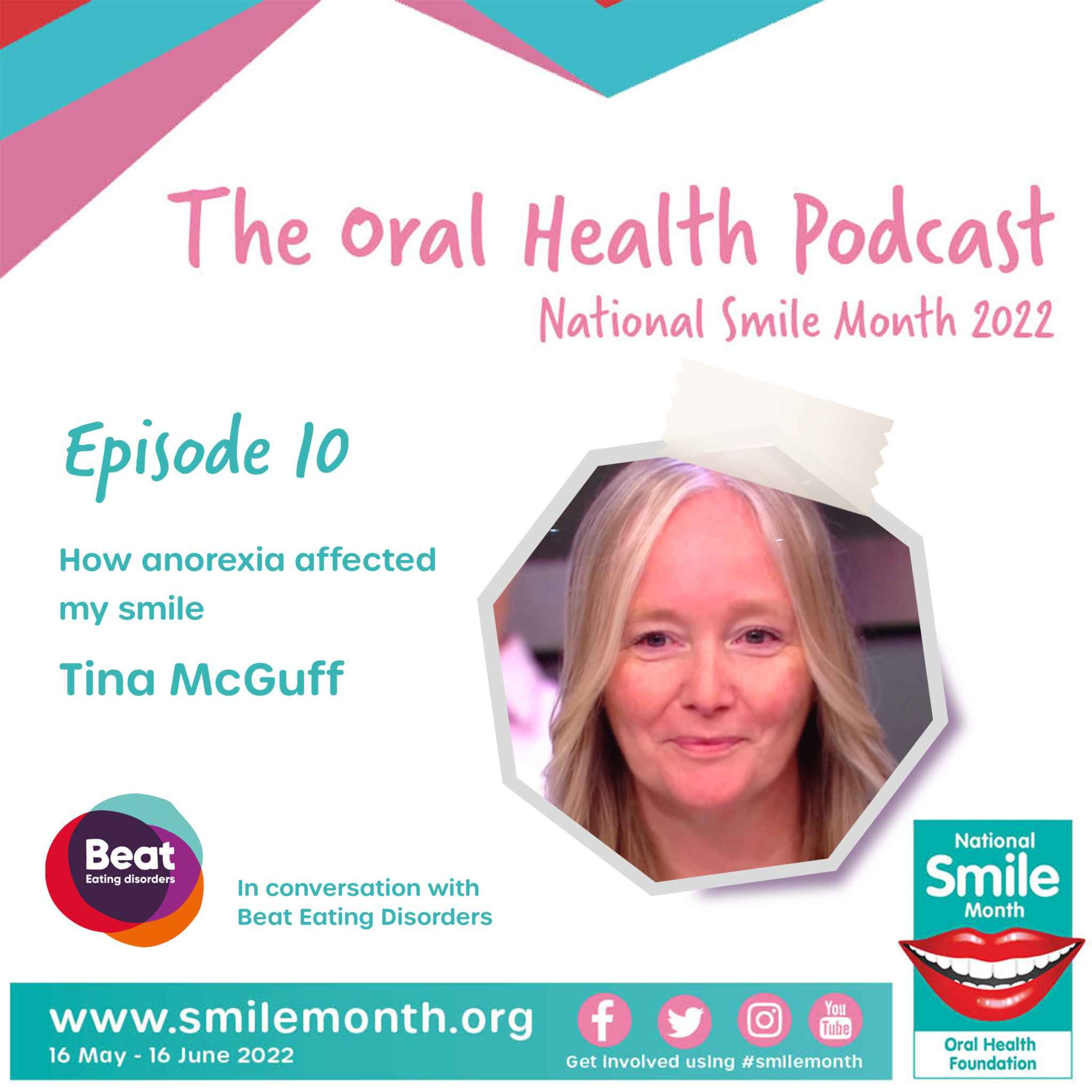 How anorexia affected my oral health
