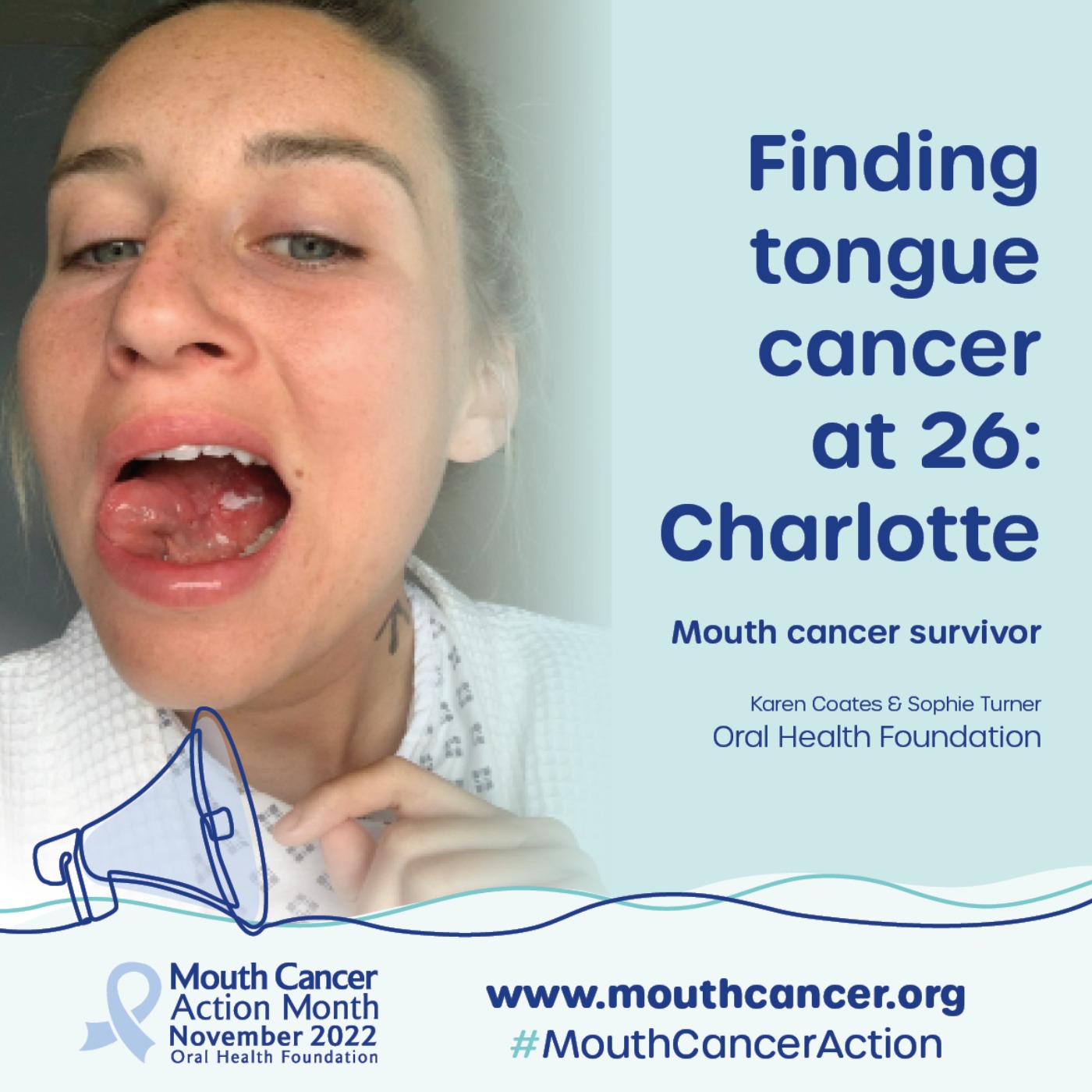 Finding tongue cancer at 26: My Mouth Cancer Story - The Oral Health ...
