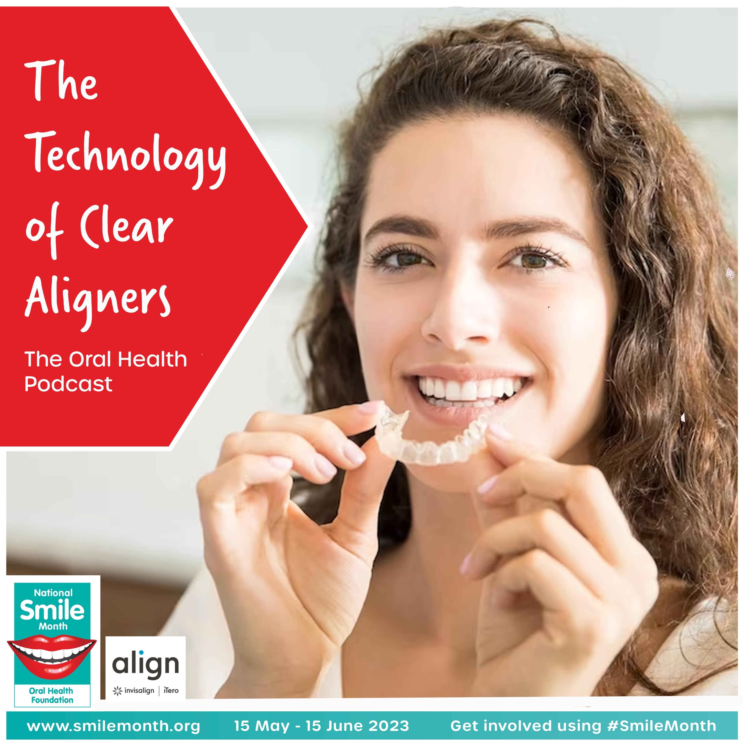 The technology of clear aligners