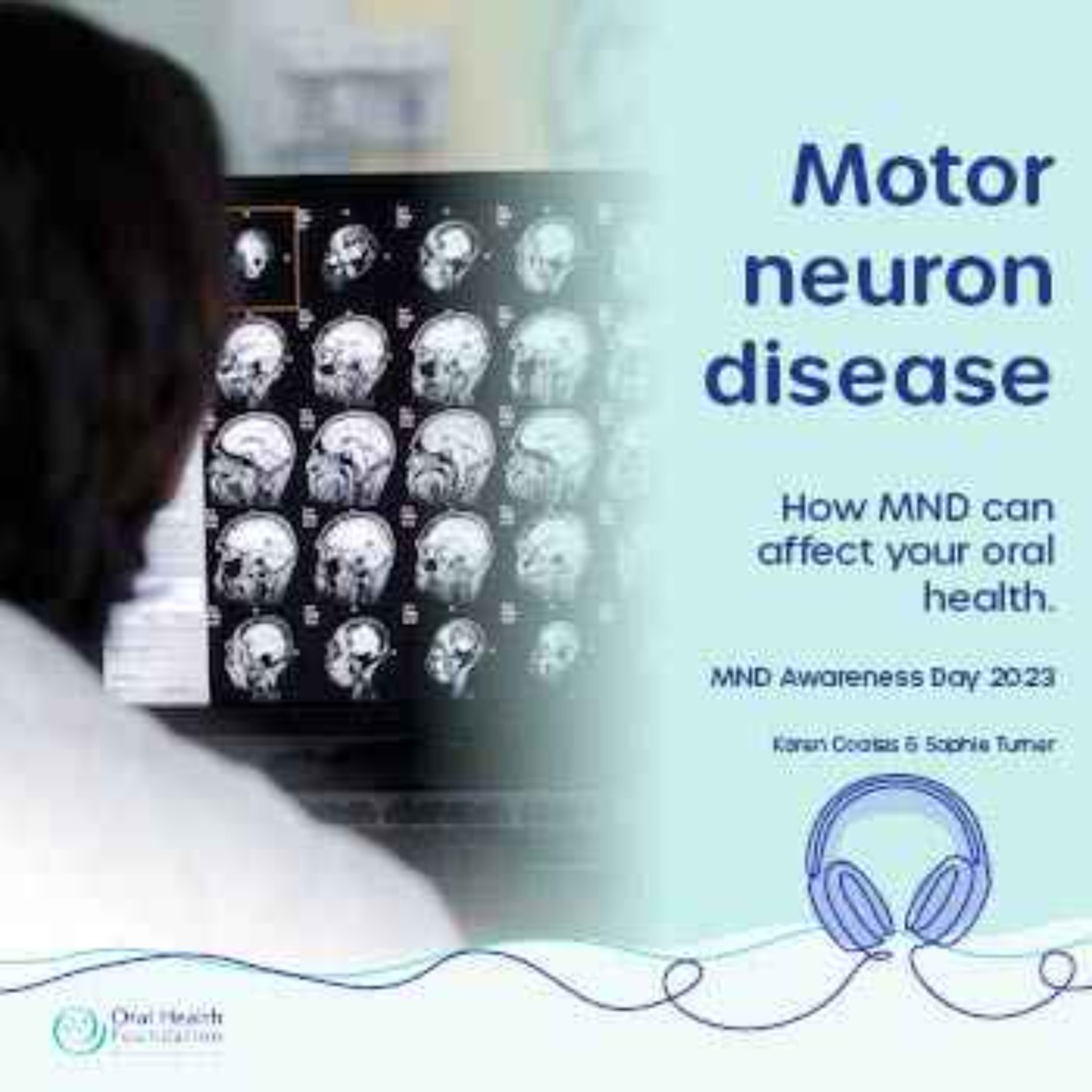 How does motor neuron disease affect your mouth health?
