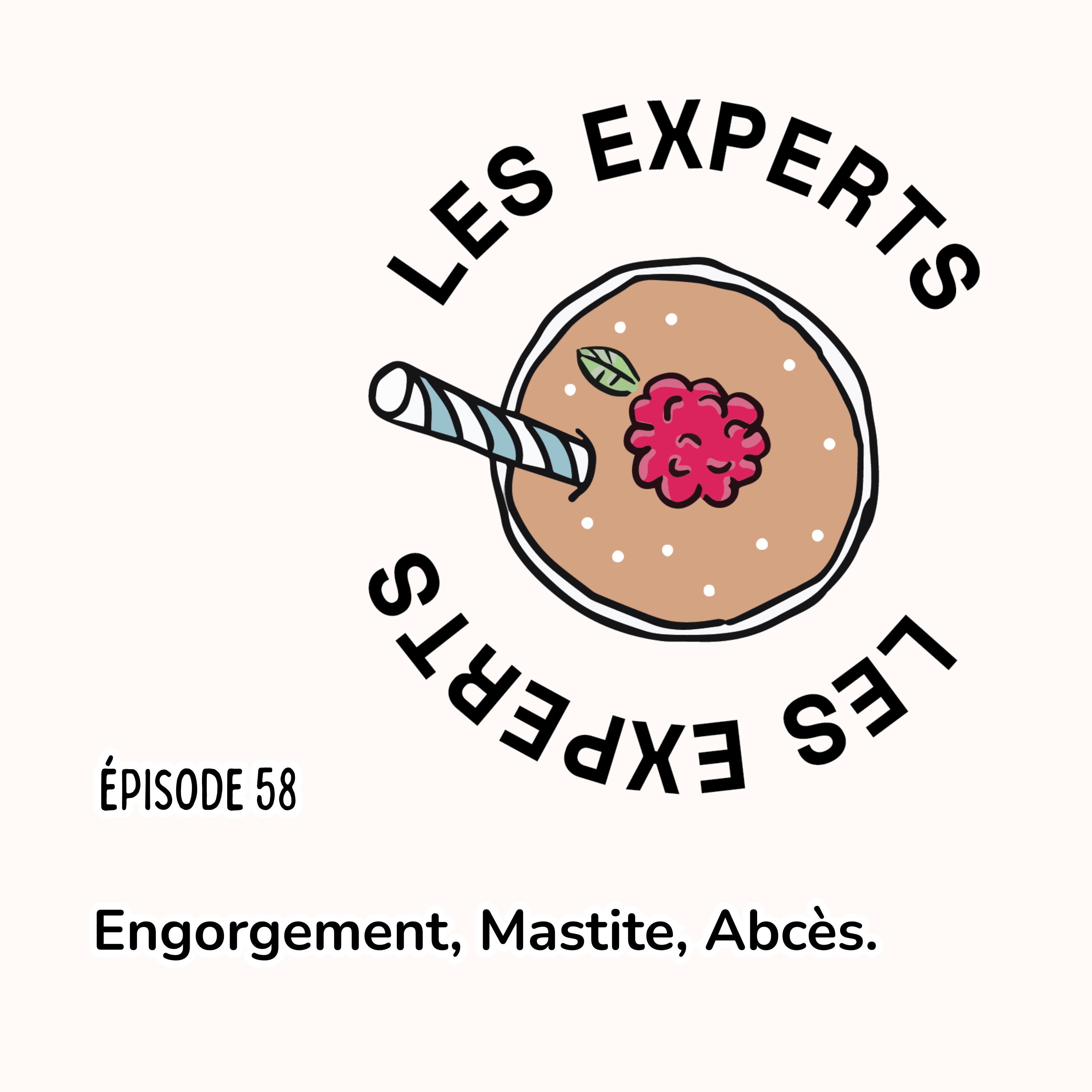 Épisode 58 - Engorgement, Mastite et abcès du sein