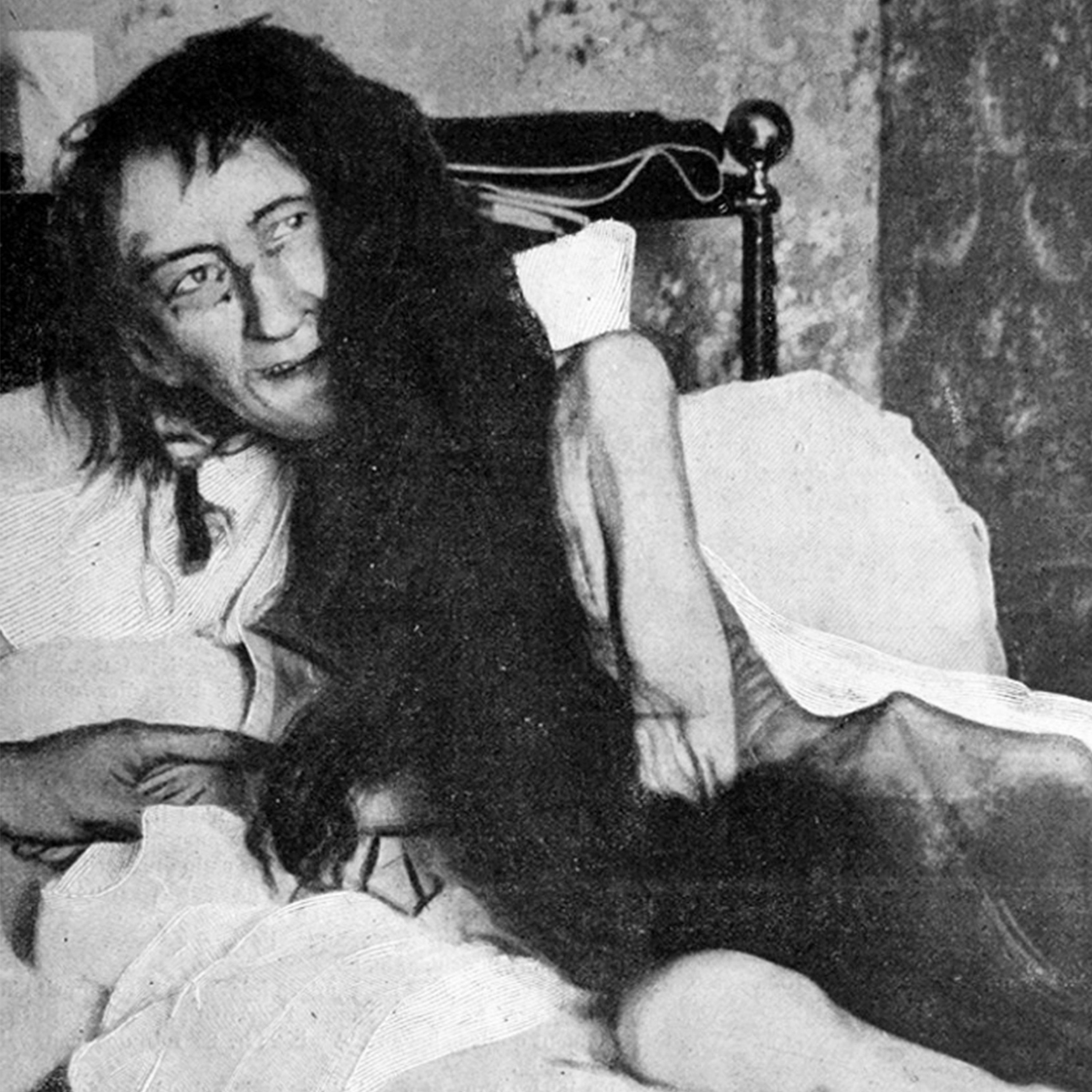 C'est arrivé le 23 mai 1901 : découverte de Blanche Monnier, enfermée pendant 25 ans dans le noir
