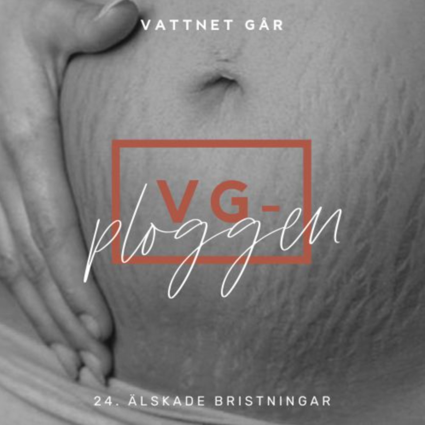 630. VG-ploggen - Våra bristningar (Repris)