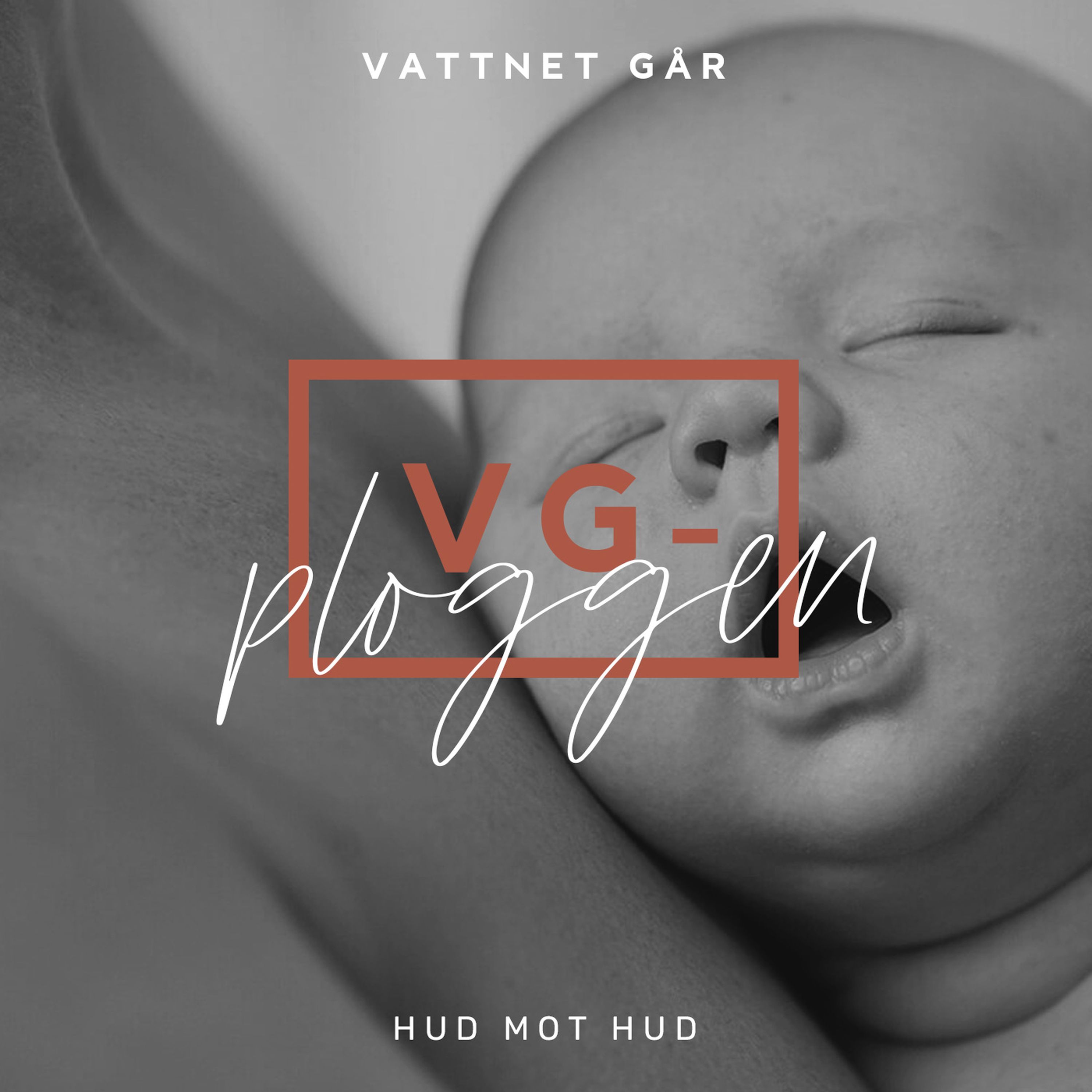 258. VG-ploggen - Hud mot hud är nyckeln!