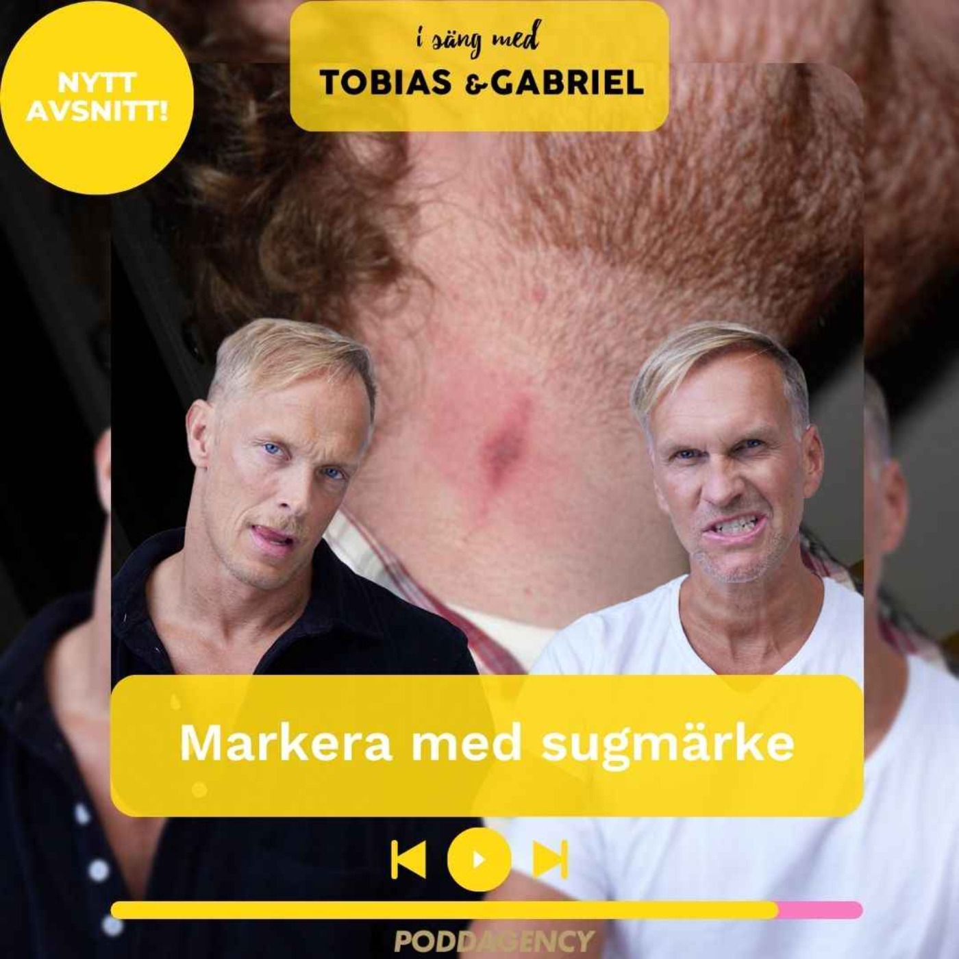 404. Markera med sugmärke episode artwork