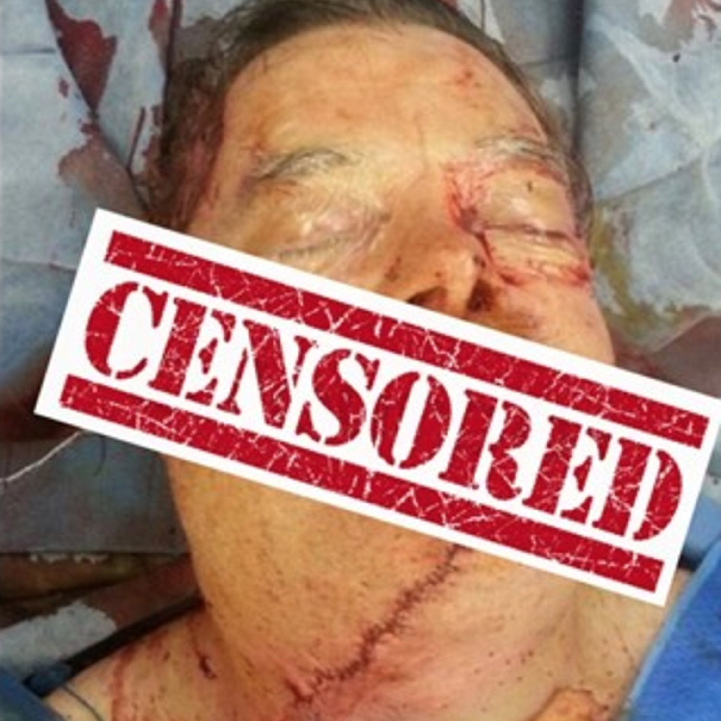 cover of episode I sliced off my face with a chainsaw!