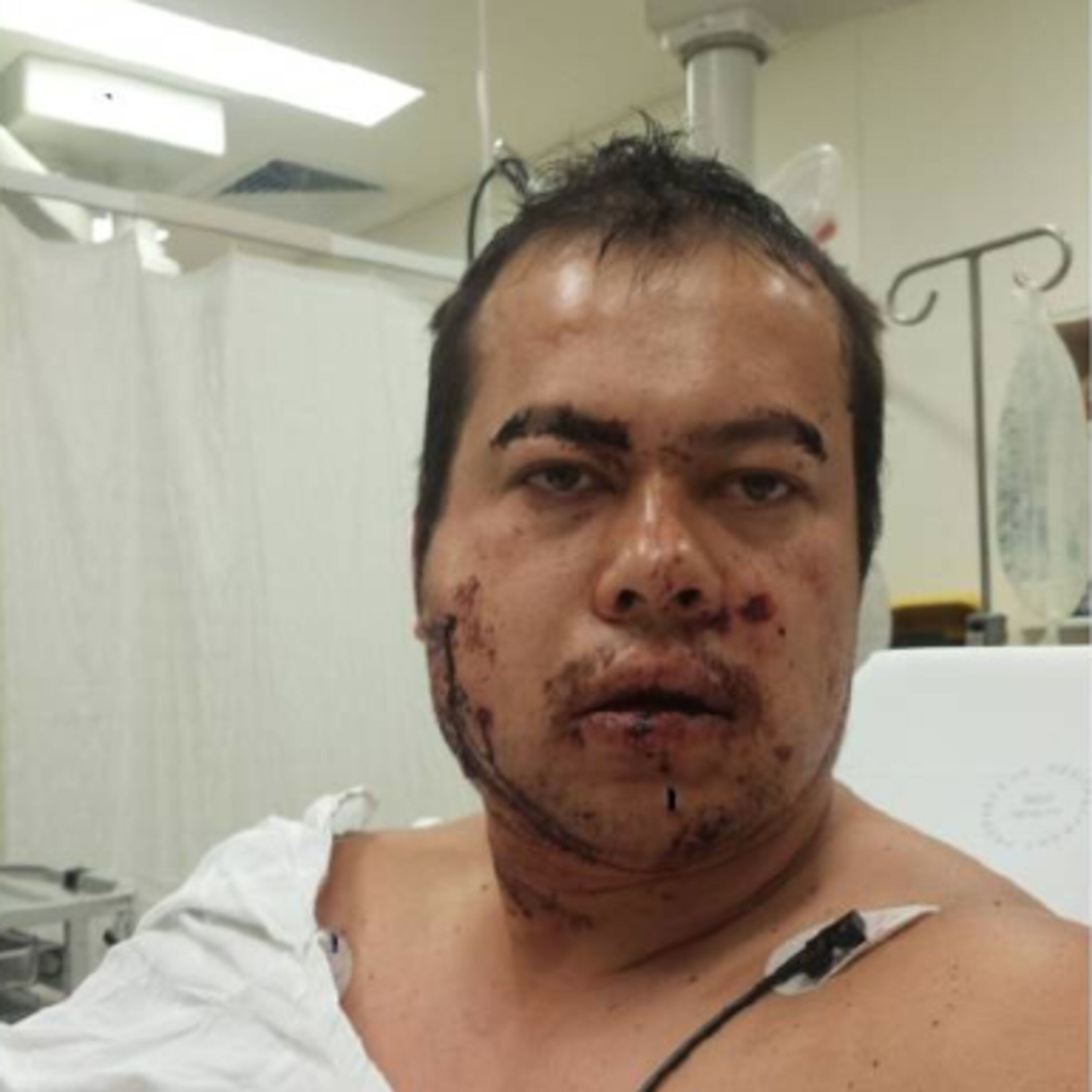 cover of episode "I was shot in the face by a stranger"