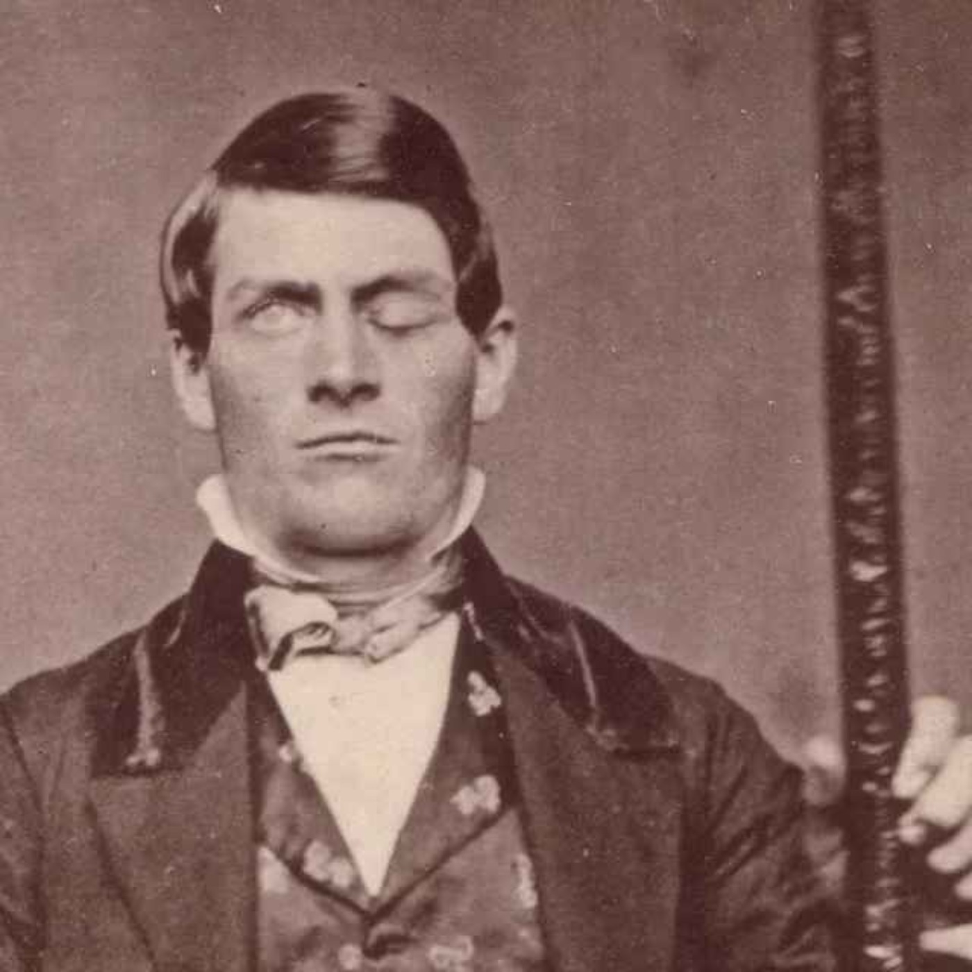 The Man With The Hole In His Head Today In History with The Retrospectors on Acast