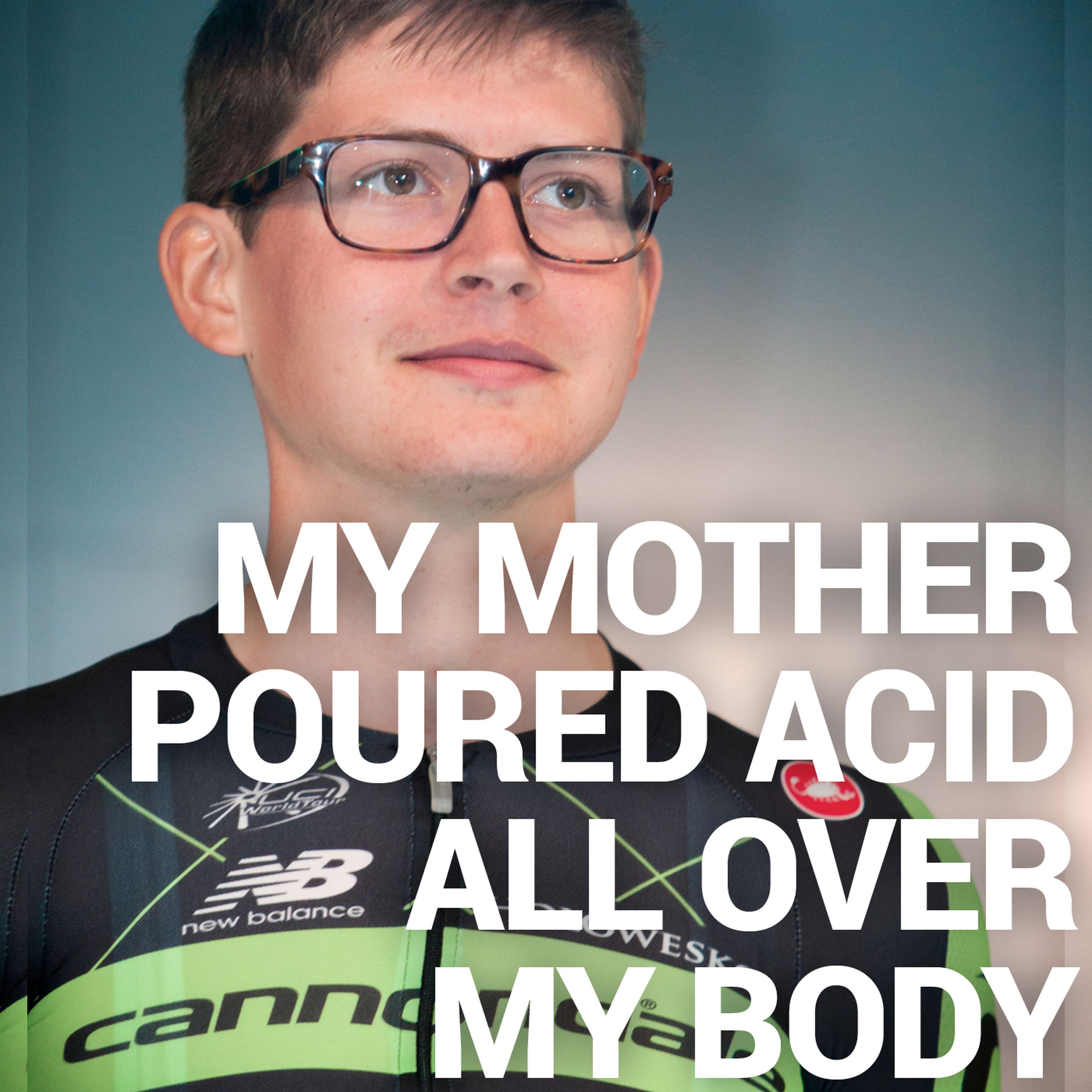 My Mother Poured Acid All Over My Body