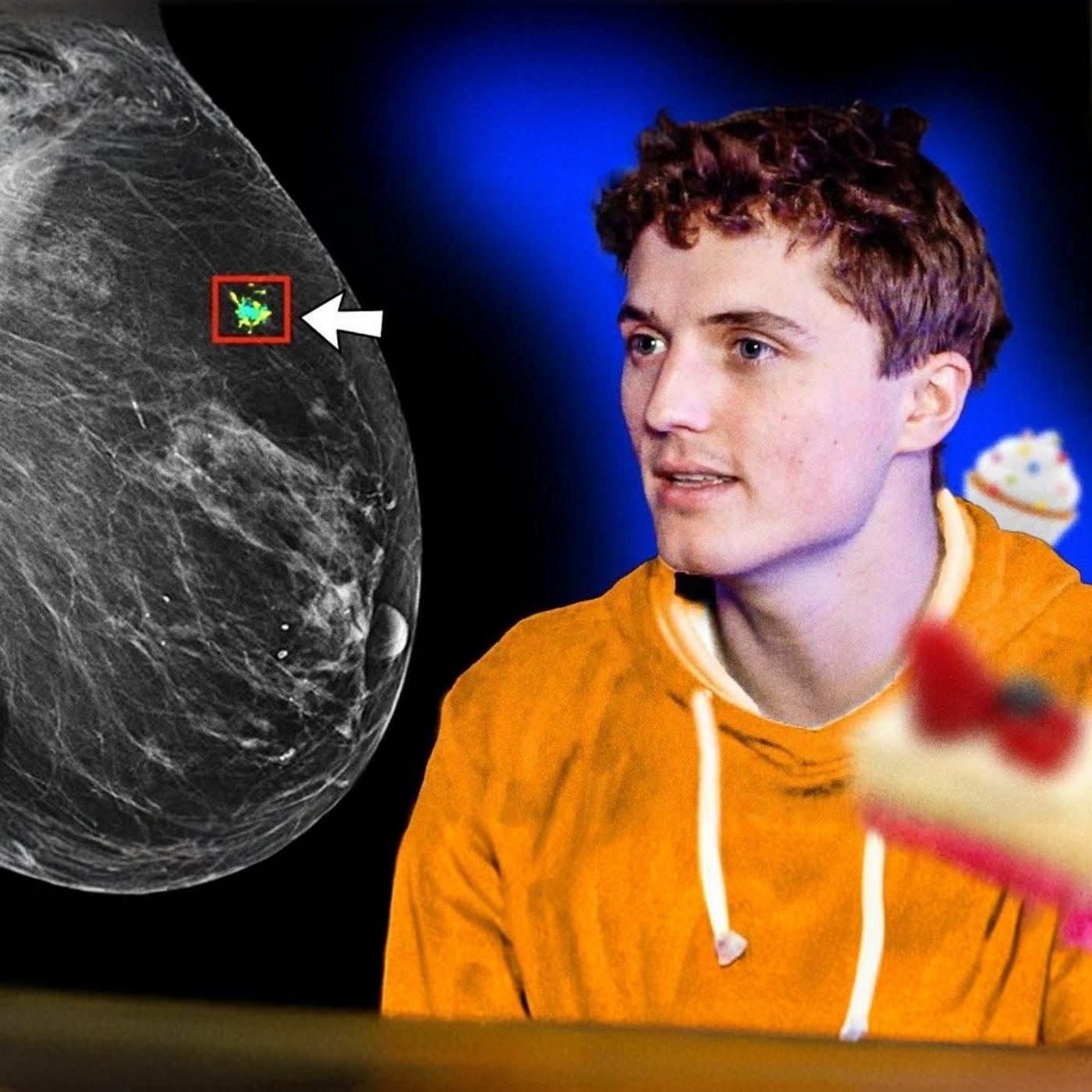 Ce scanner reconnaît les cancers par accident — chronique Matthieu Lambda