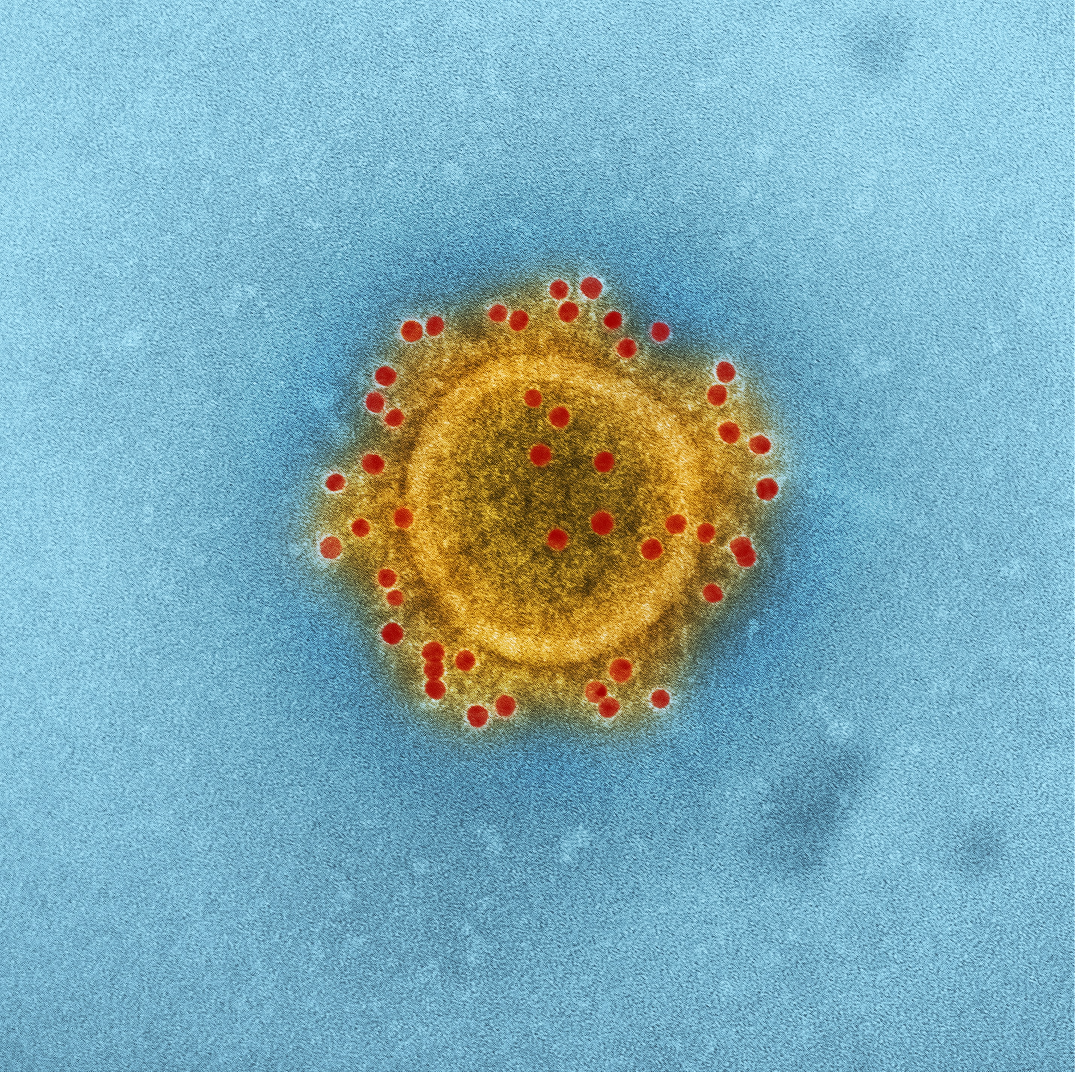 Un vaccin contre le Covid-19, mais rien contre le VIH ? Le podcast