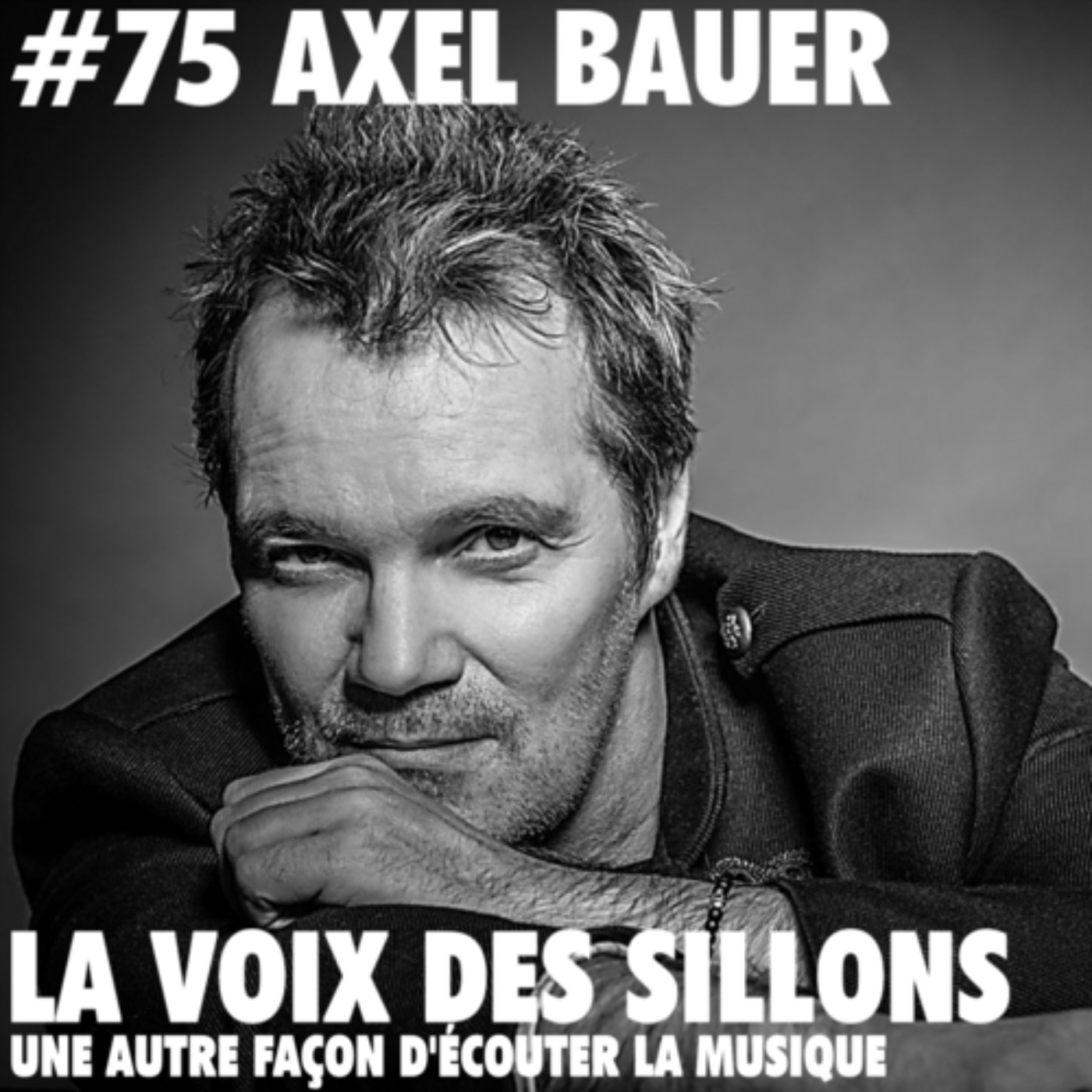 Axel Bauer