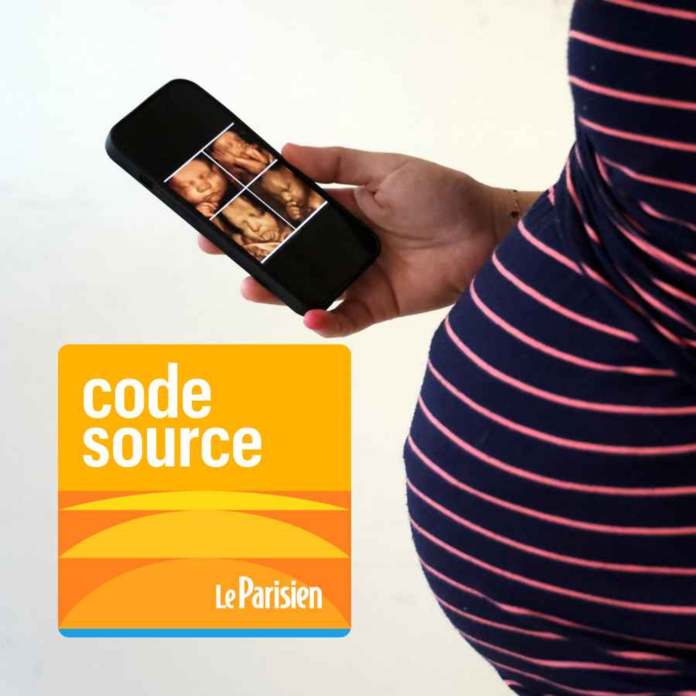 Grossesse : enquête sur le business illégal des « échographies de plaisir »