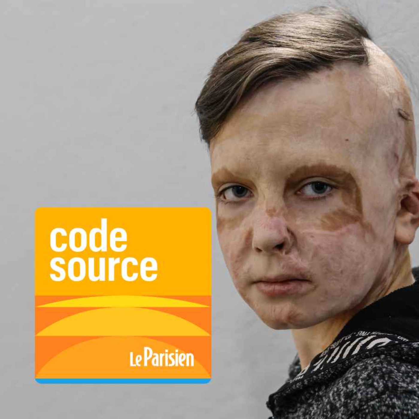 Code source - « Gueules cassées », épuisement… La vie des Ukrainiens après 4 ans de guerre