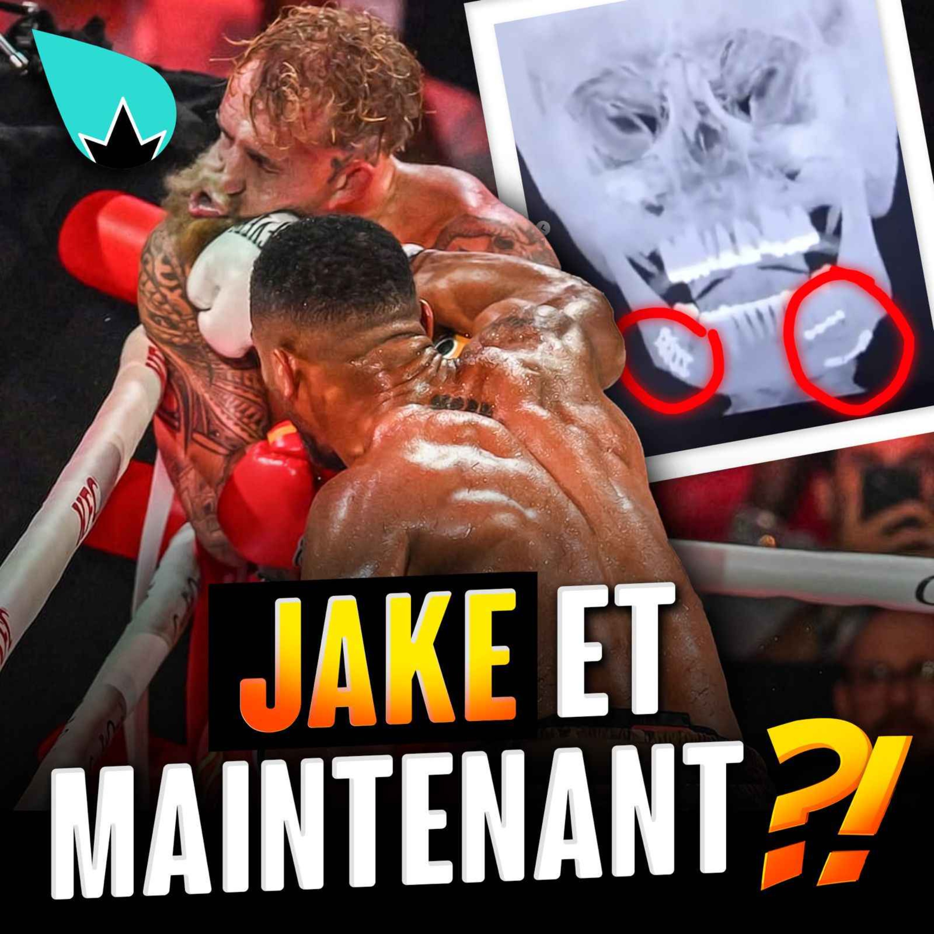 Jake Paul : ET MAINTENANT ? episode artwork