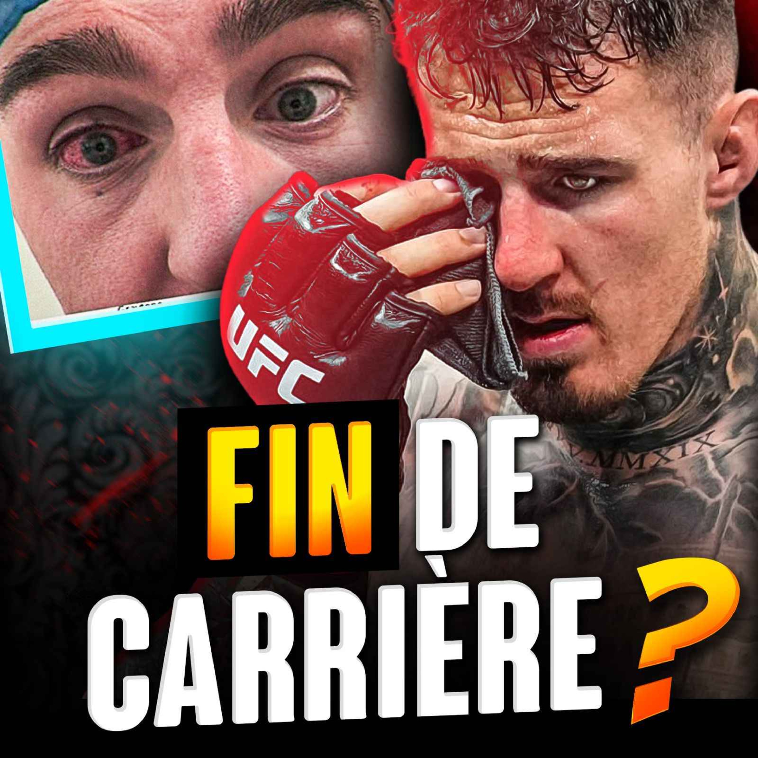La situation Tom Aspinall