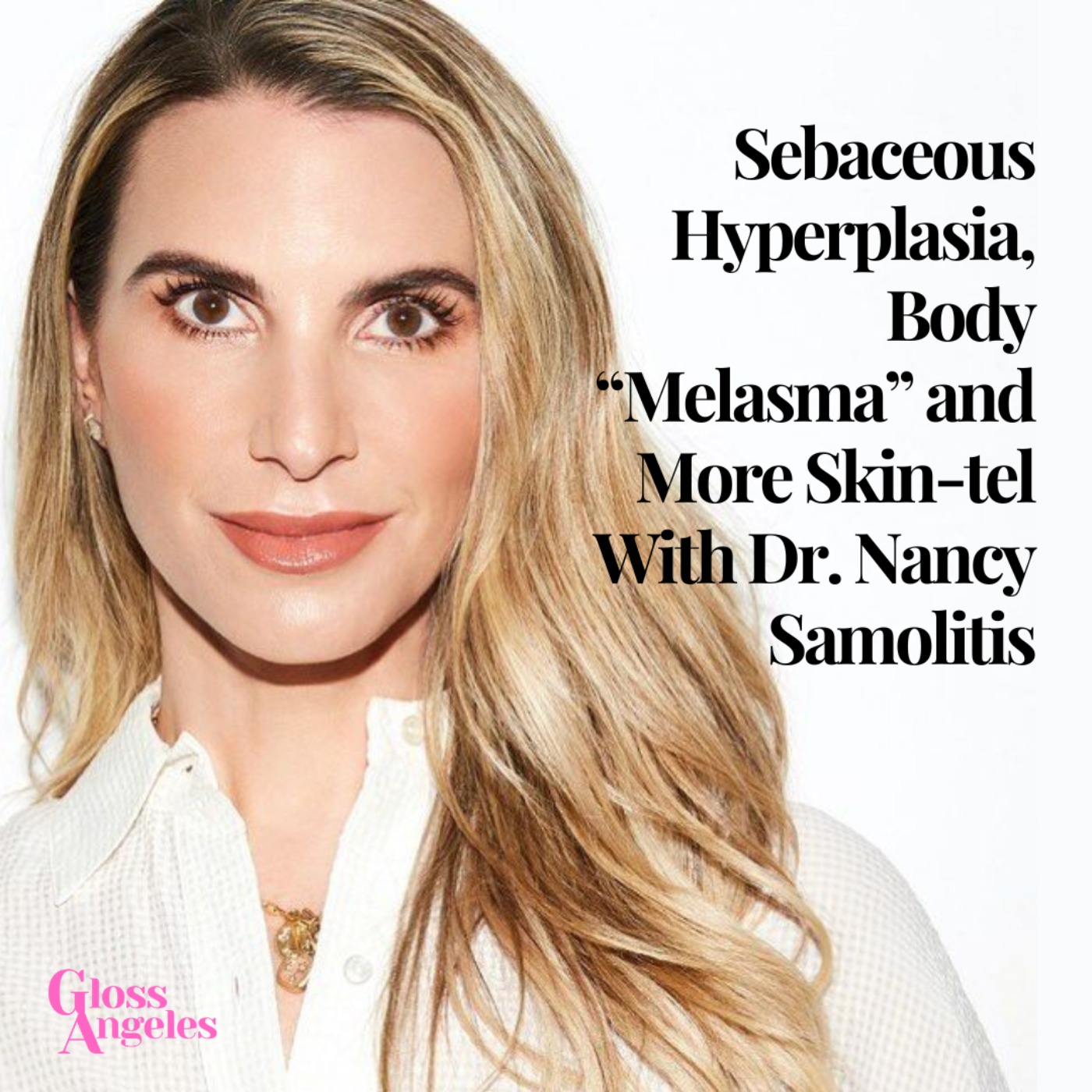 cover art for Sebaceous Hyperplasia, Body "Melasma" and More Skin-tel With Dr. Nancy Samolitis