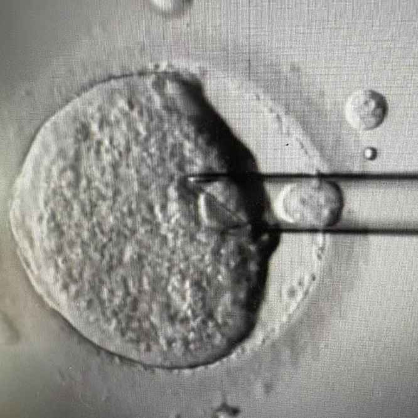 Groundbreaking IVF welcomes eight babies free from genetic disease