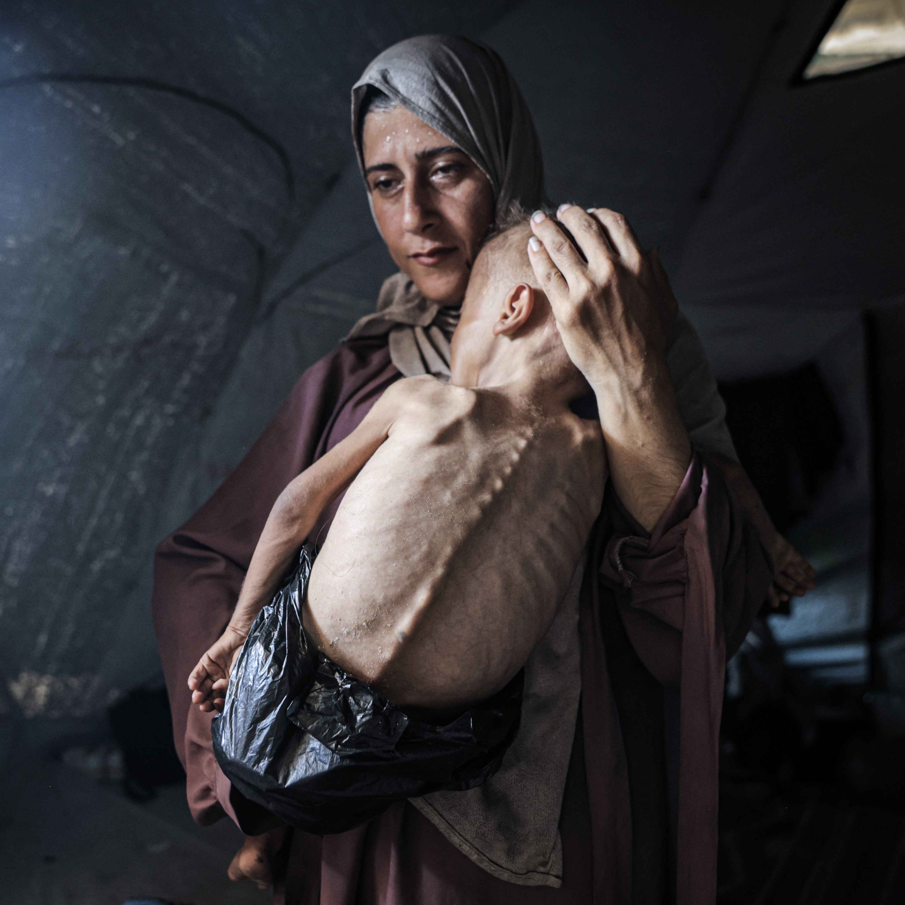 Why Palestinians Are Dying While Queuing for Food Aid