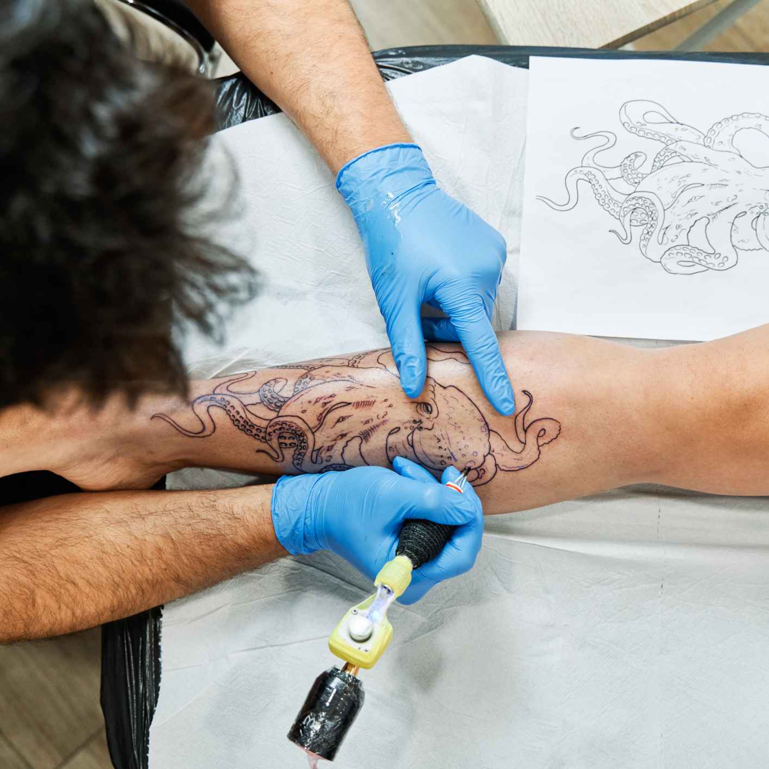 Should you get rid of unwanted tattoos? episode artwork
