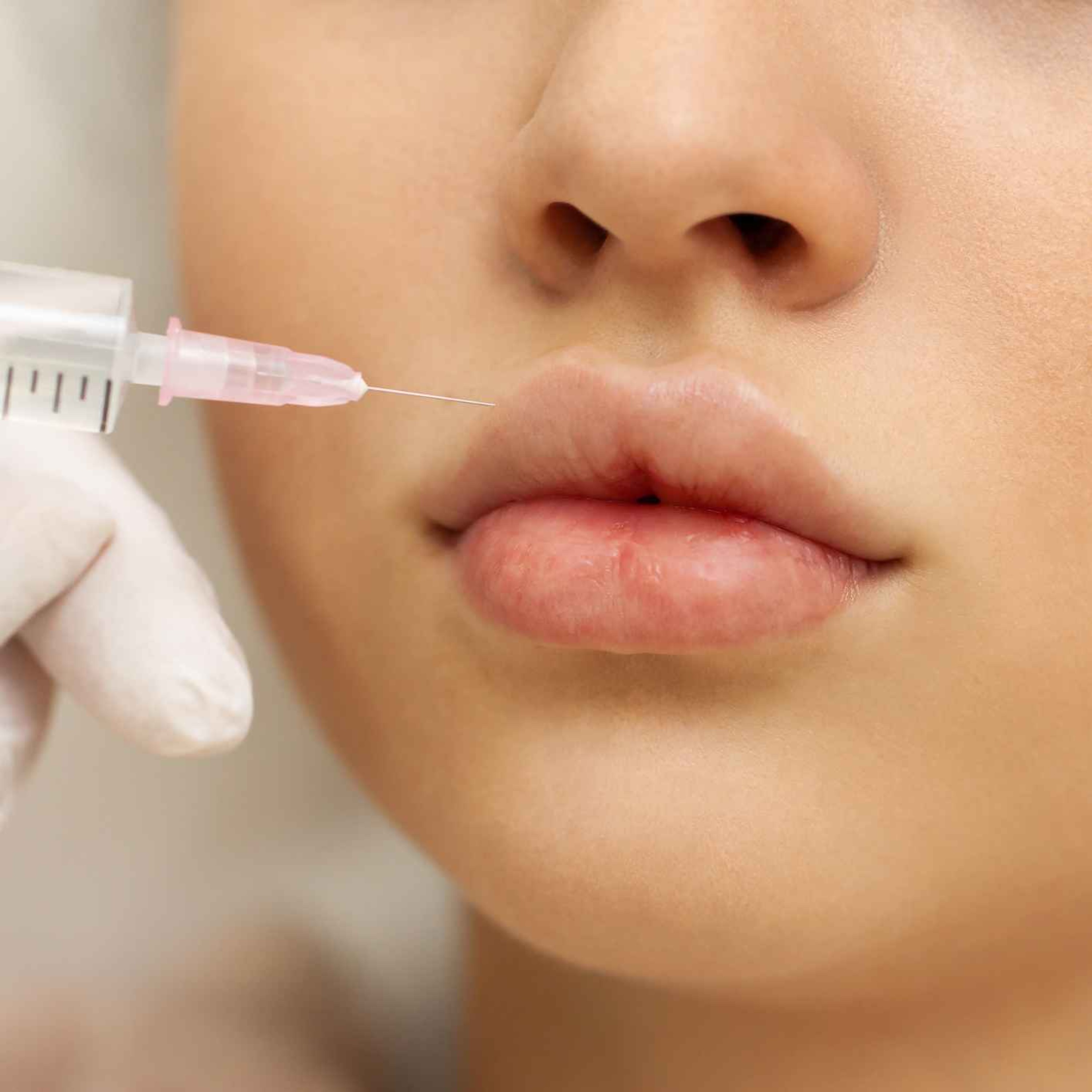 Why do young Limerick girls feel the need to get lip fillers? episode artwork