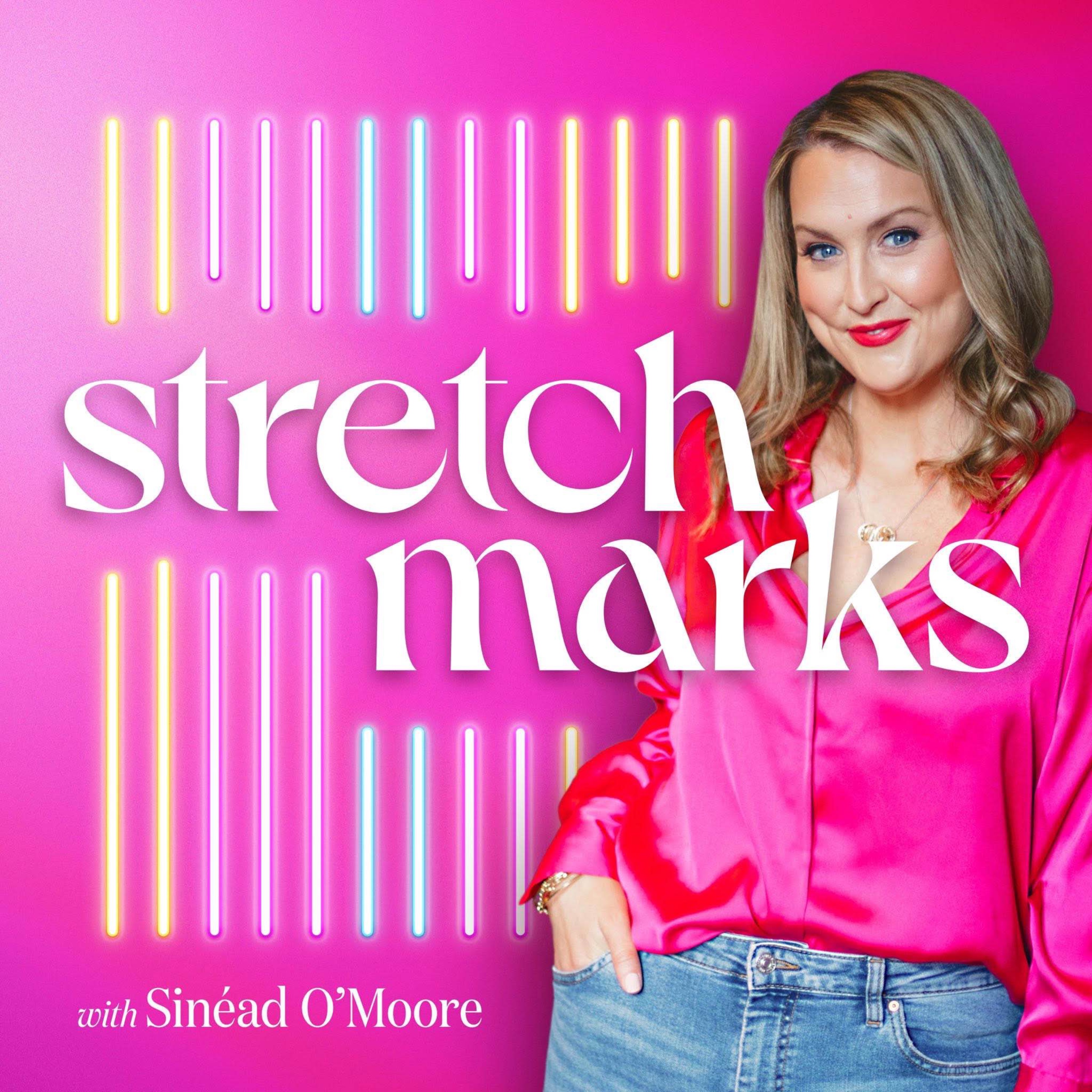 Stretch Marks: The 40\'s Stretch