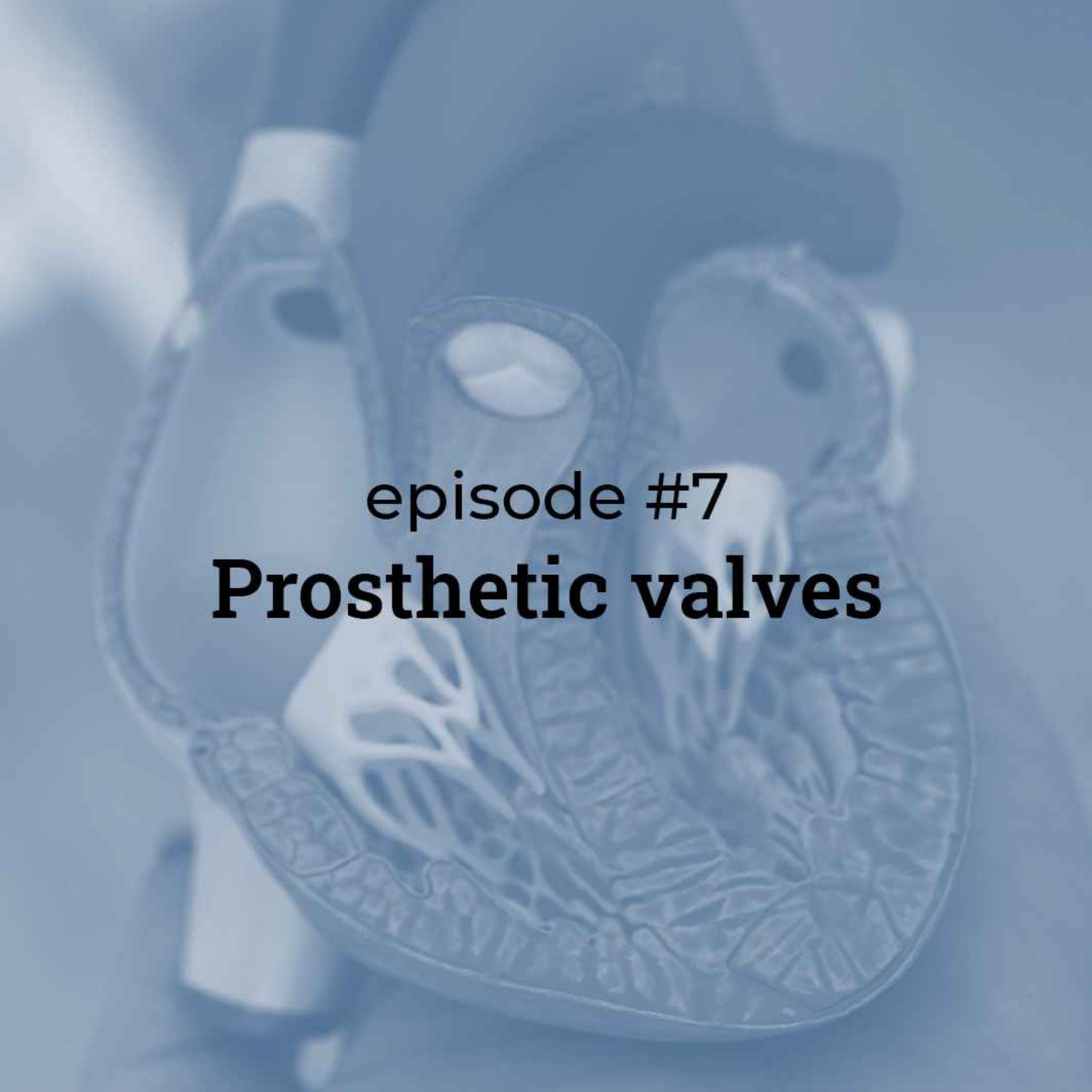 #7 Prosthetic Heart Valves