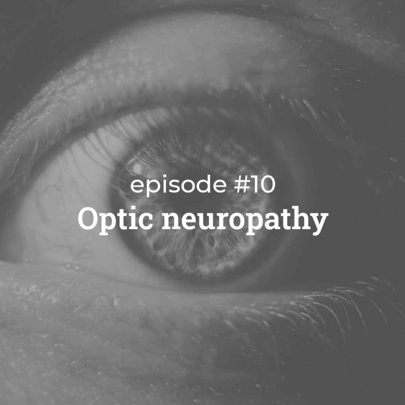 #10 Optic Neuropathy