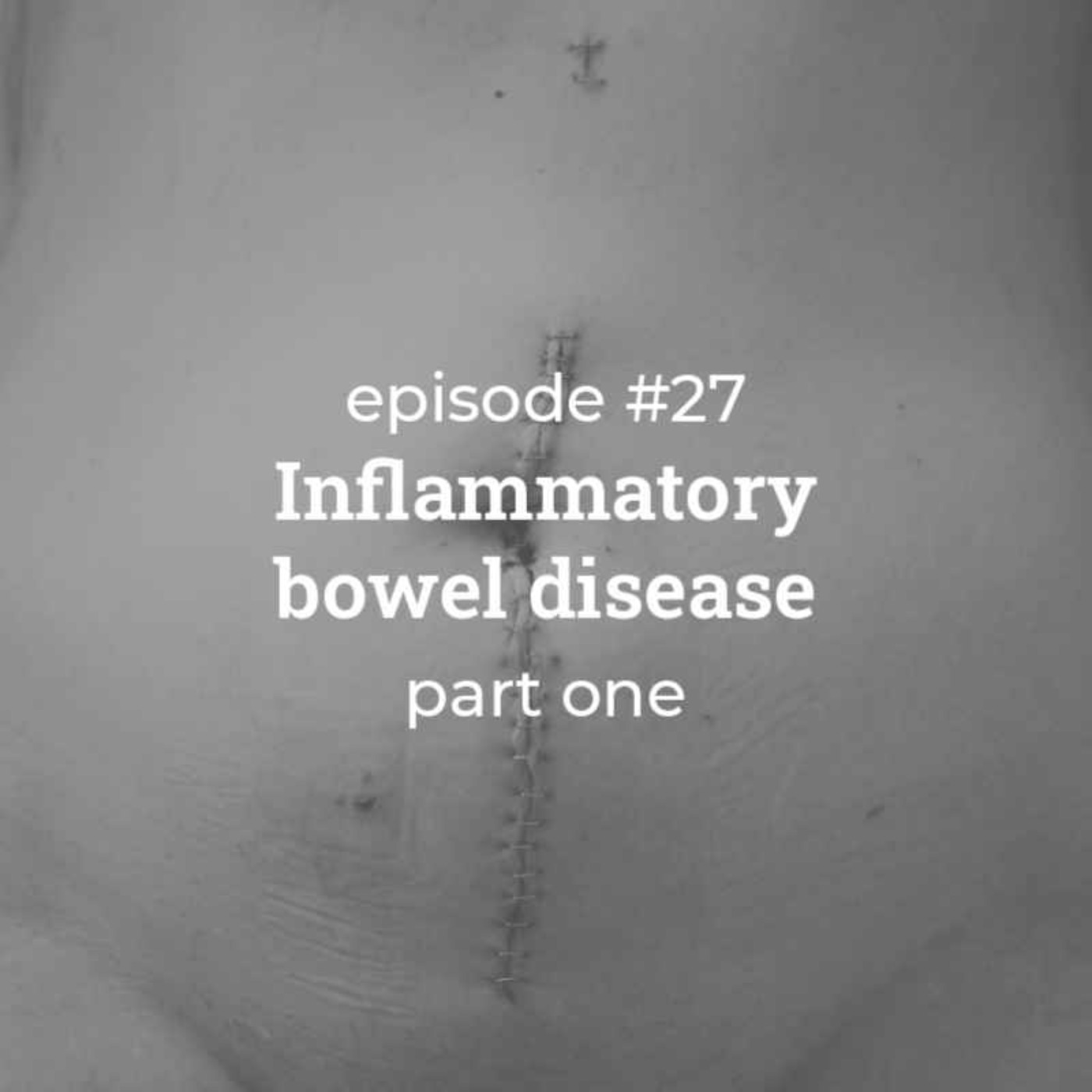 #27 Inflammatory bowel disease (part 1)