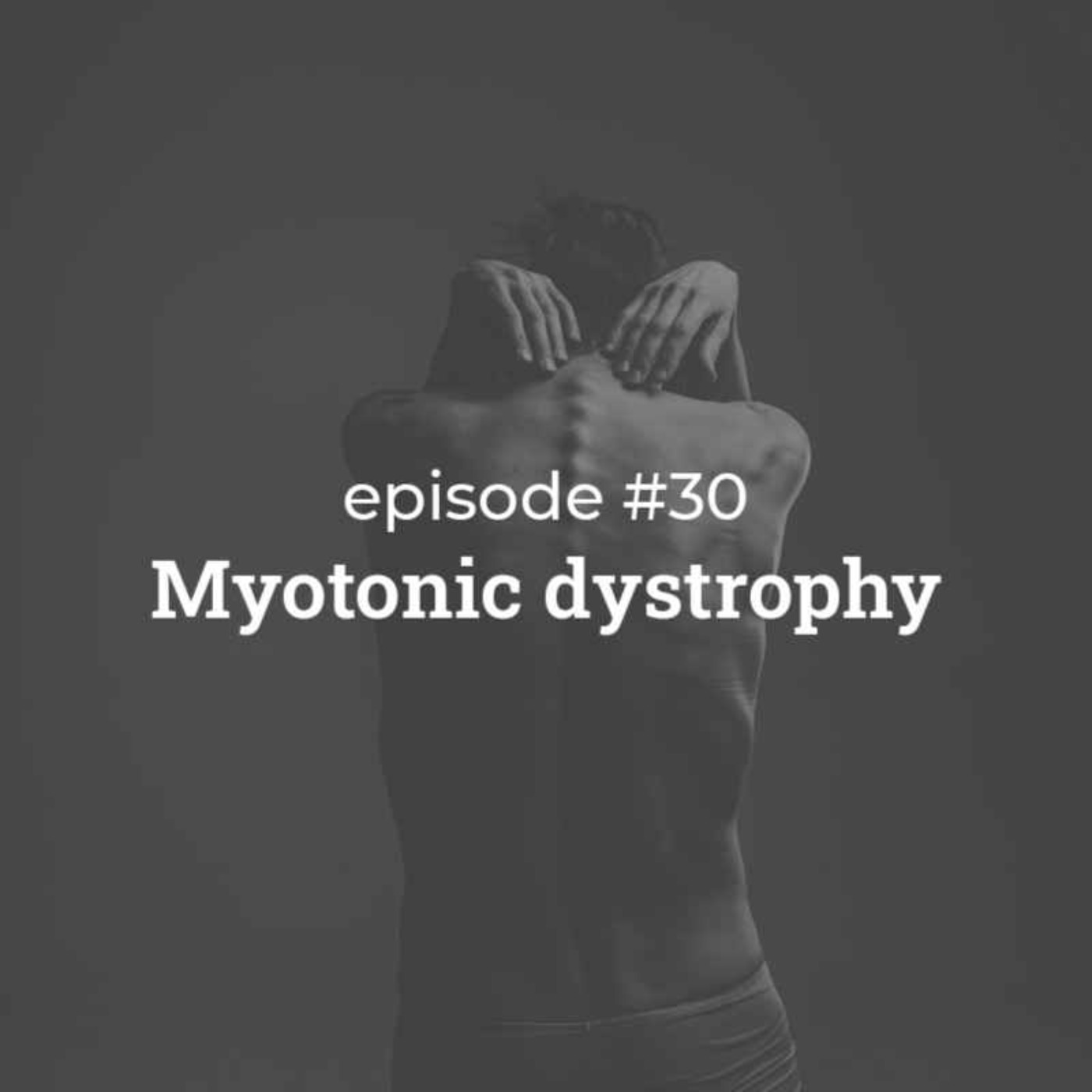 #30 Myotonic dystrophy