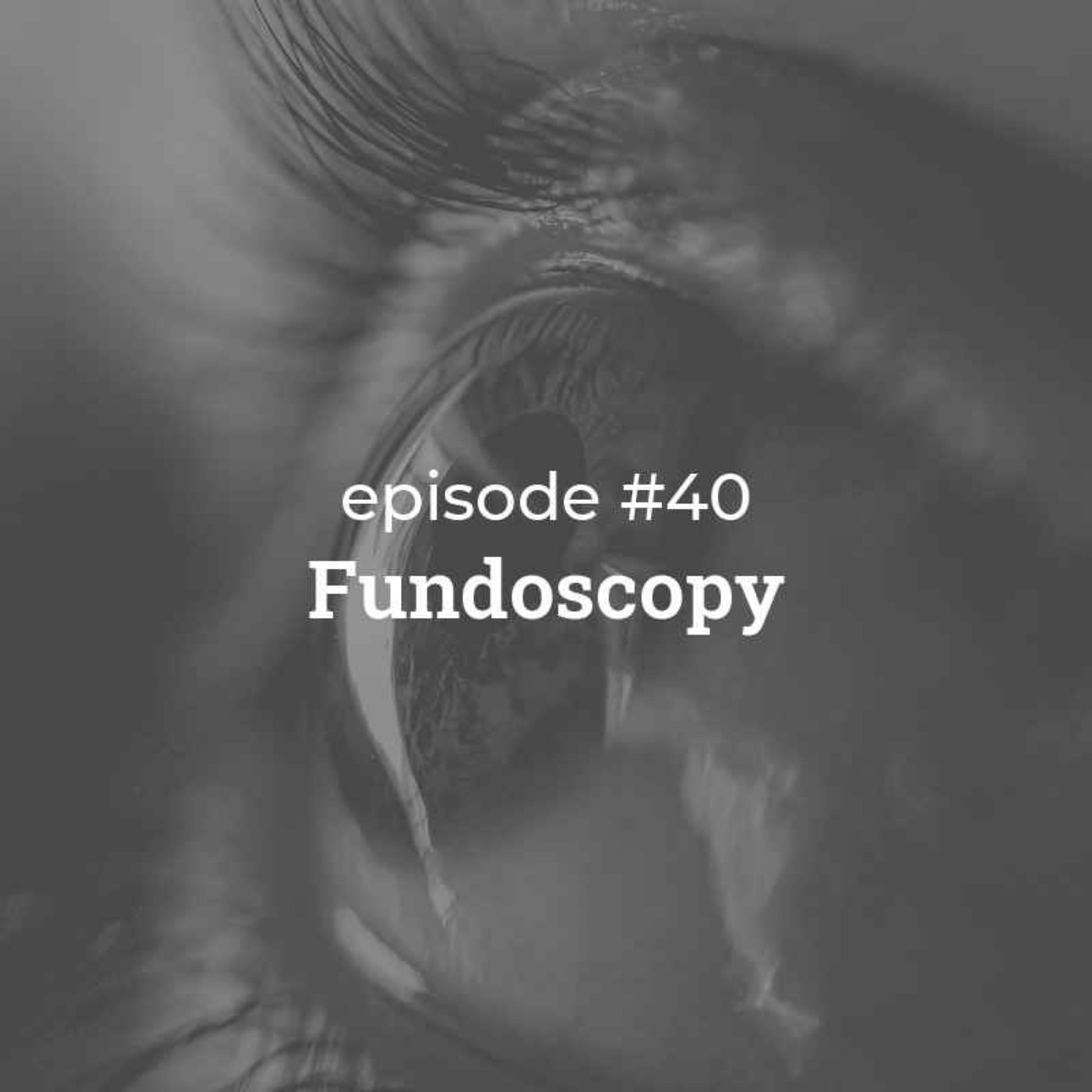 #40 Fundoscopy