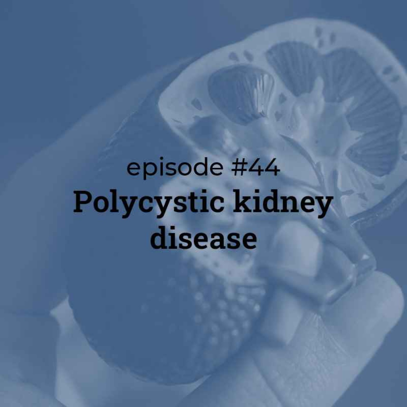 #44 Polycystic kidney disease