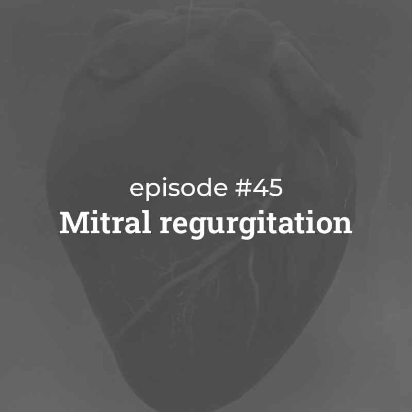 #45 Mitral Regurgitation
