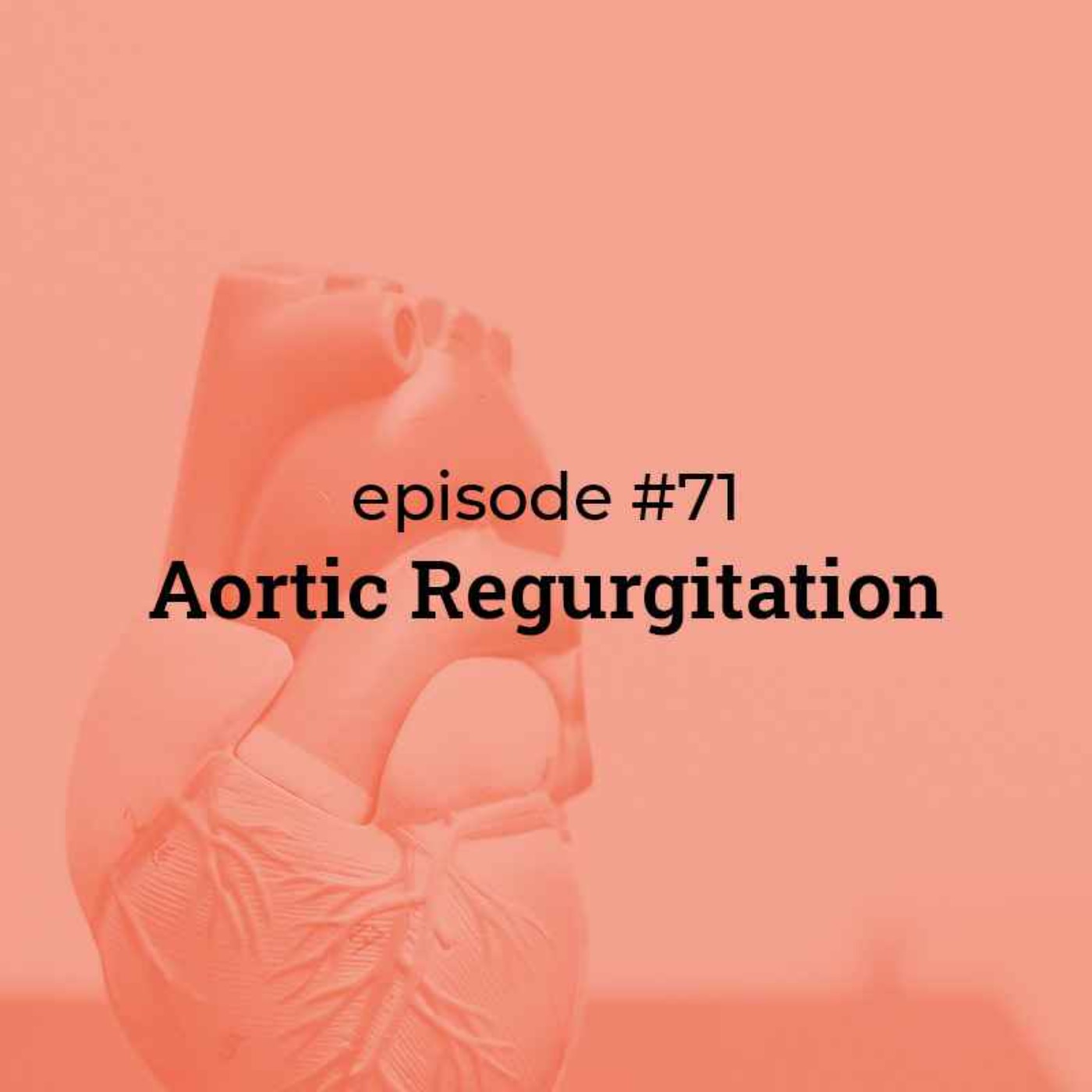 #71 Aortic regurgitation