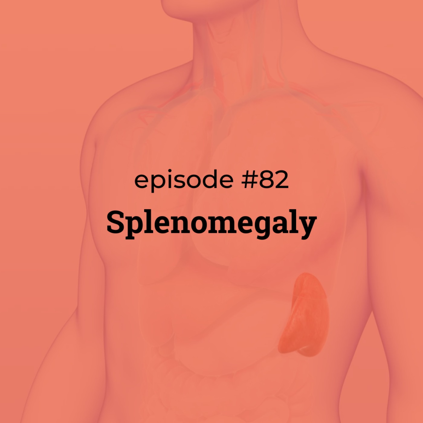 #82 Splenomegaly