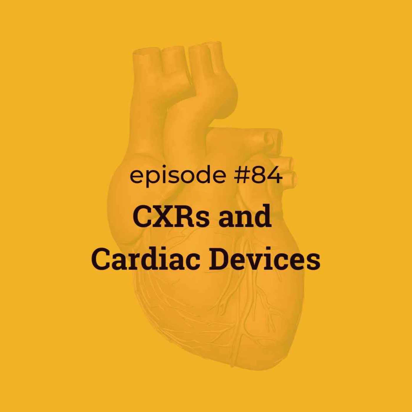 #84 CXRs & Cardiac Devices